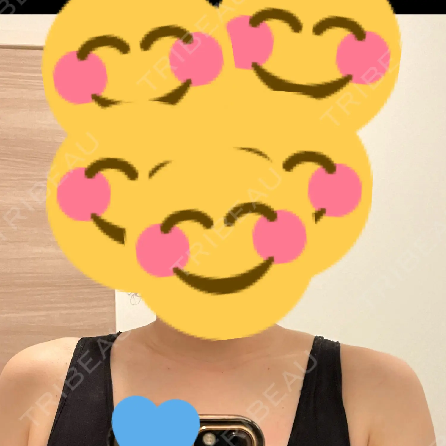 施術後の写真
