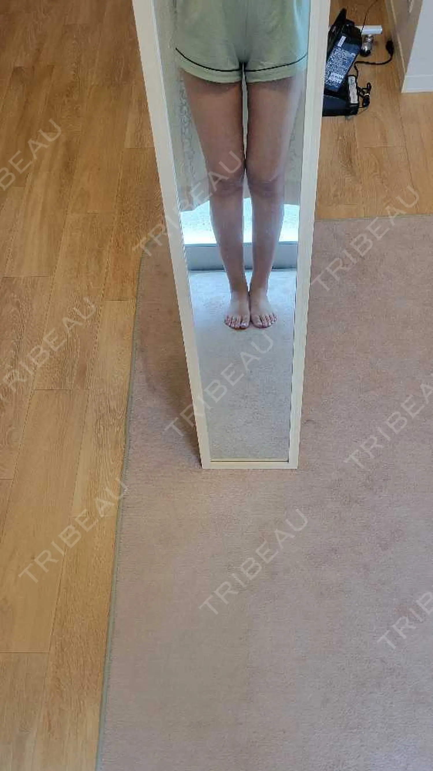 施術後の写真