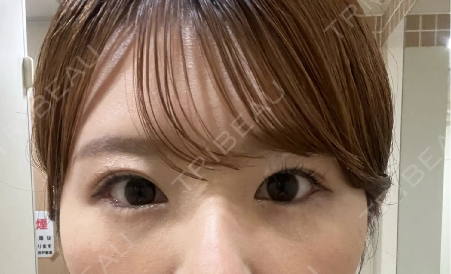 施術後の写真
