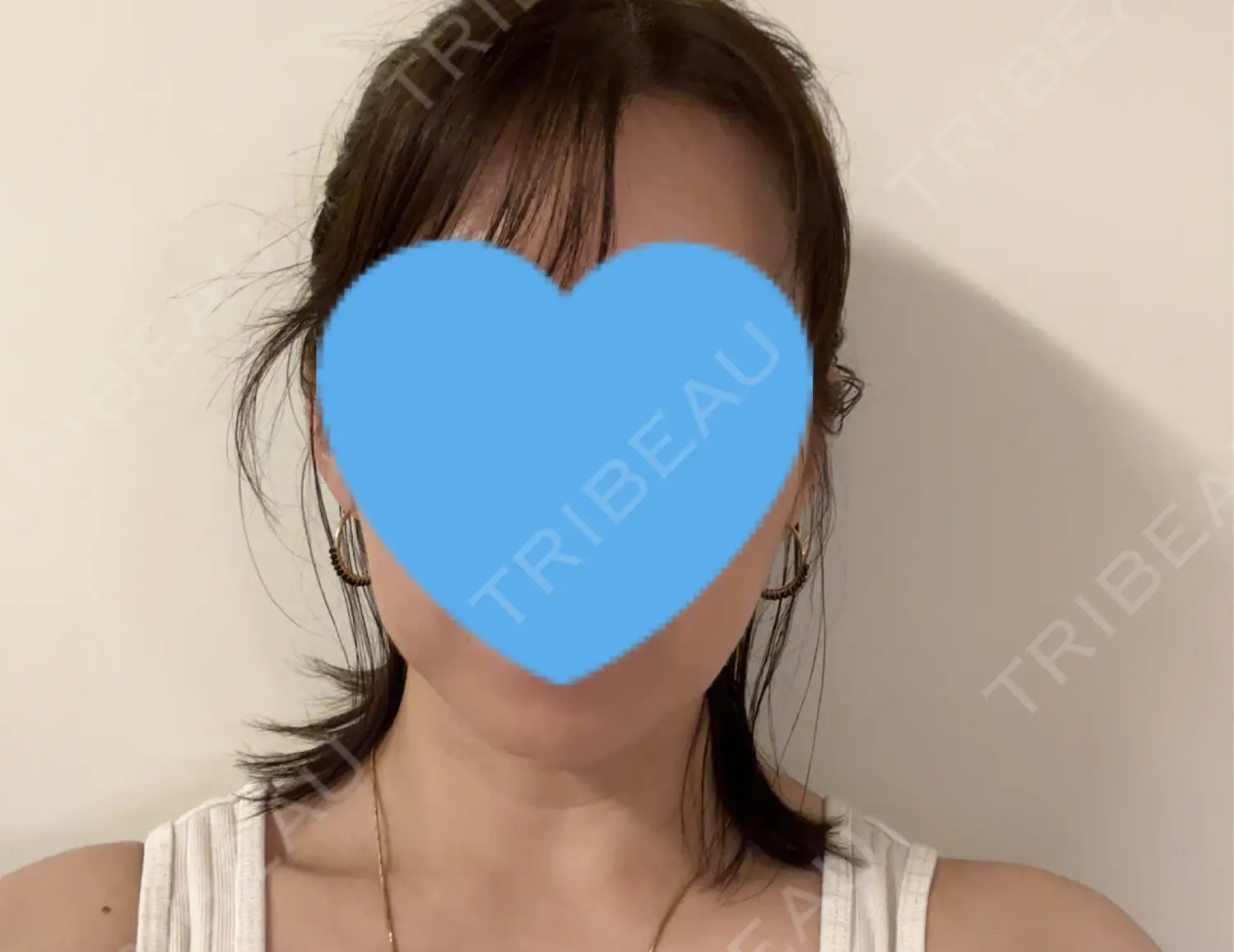 施術後の写真