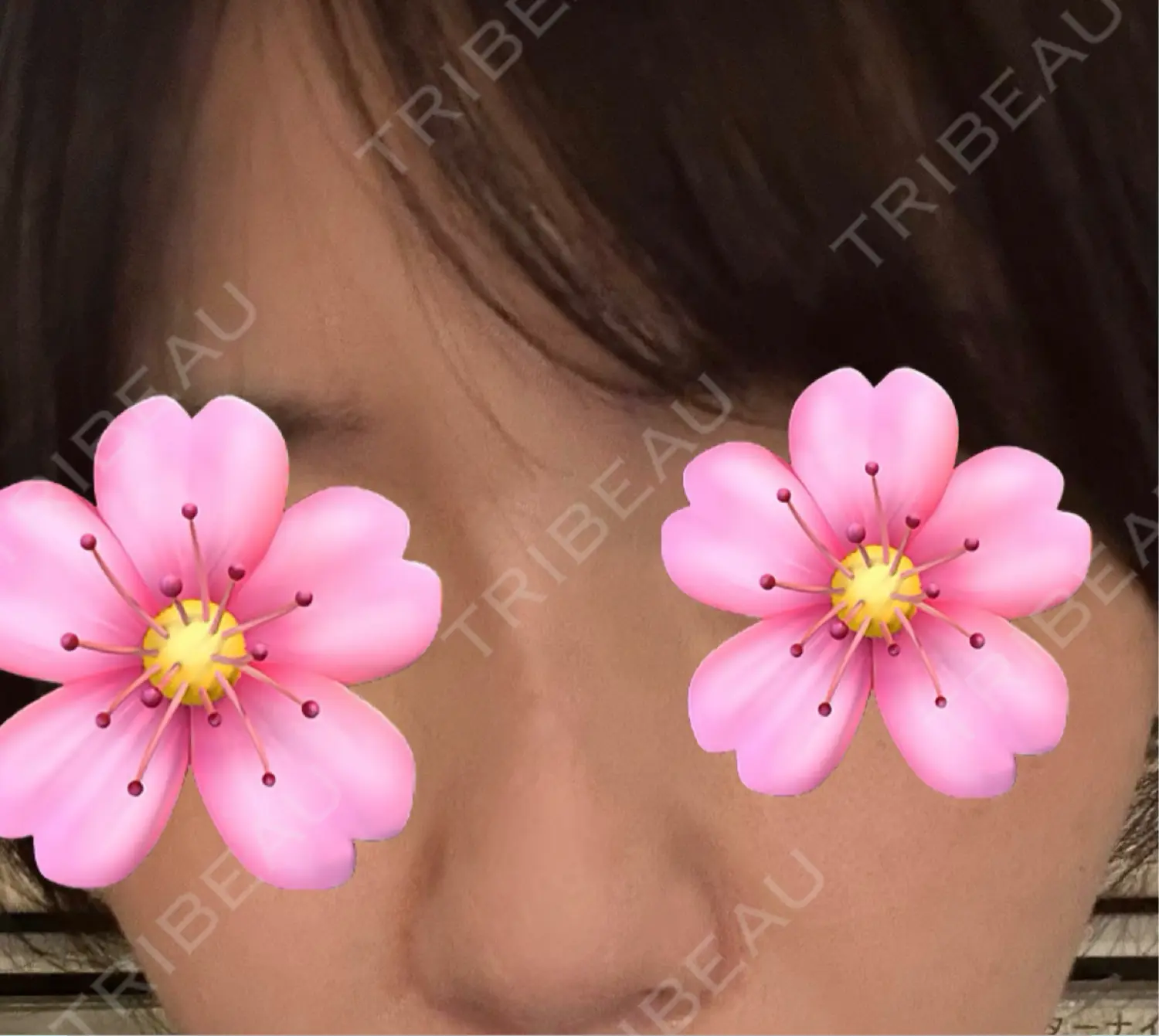 施術後の写真
