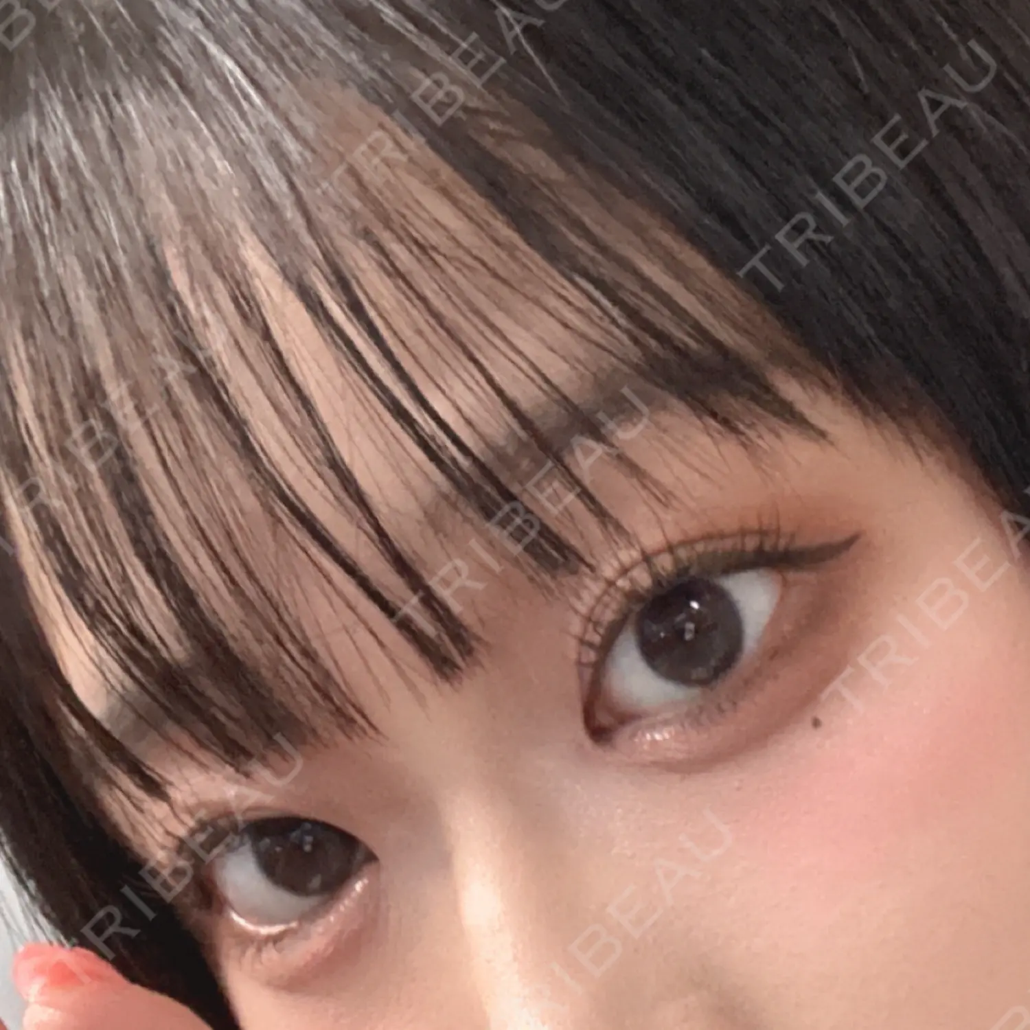施術後の写真