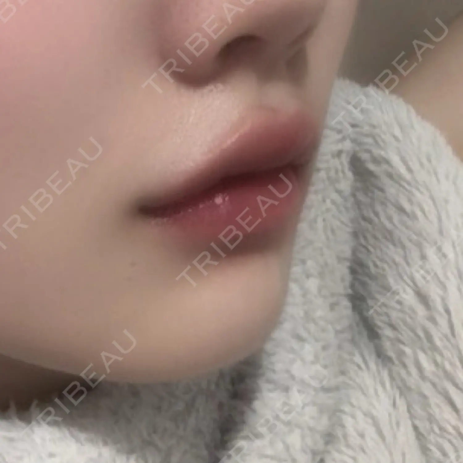 施術後の写真