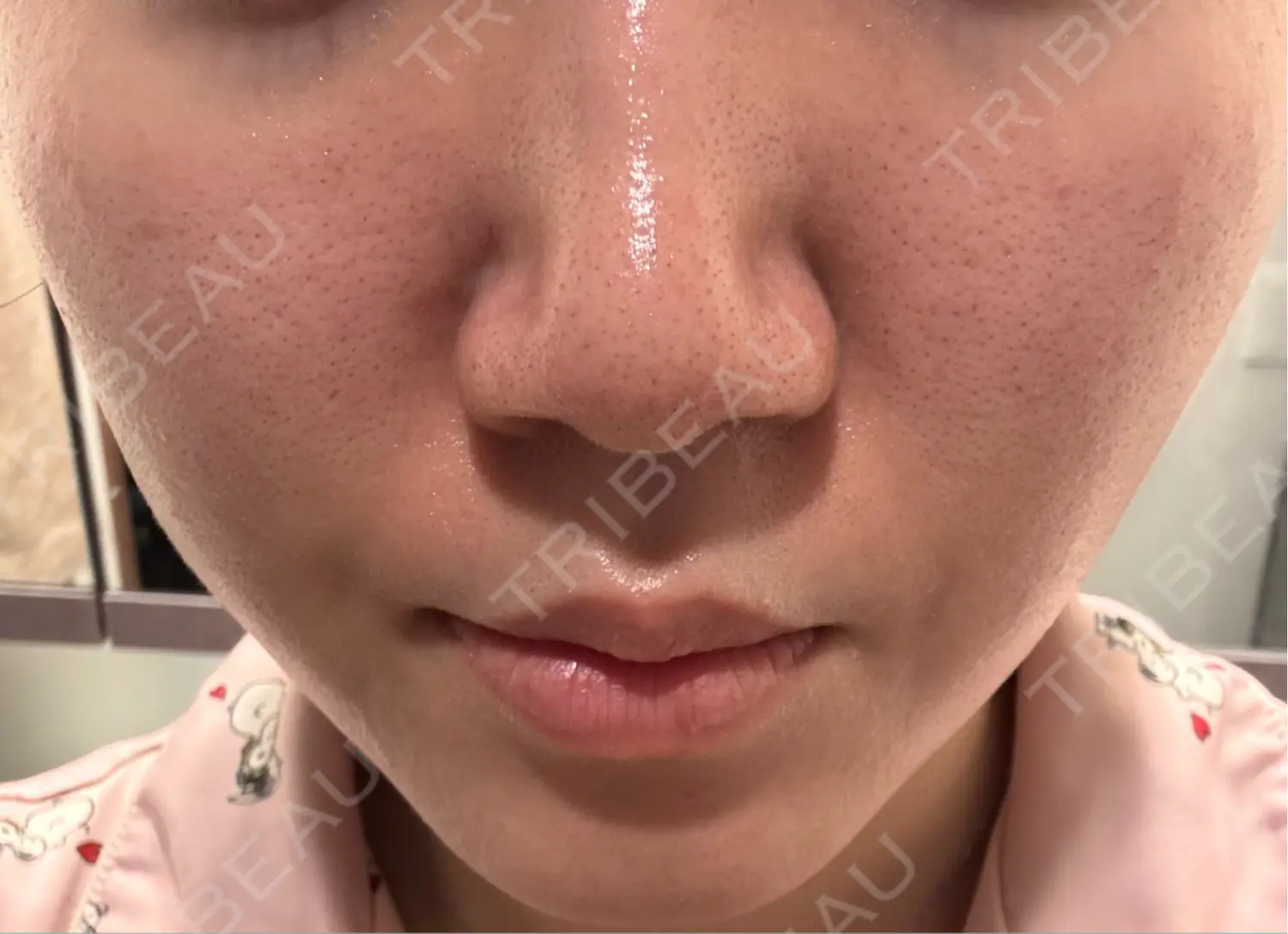 施術後の写真