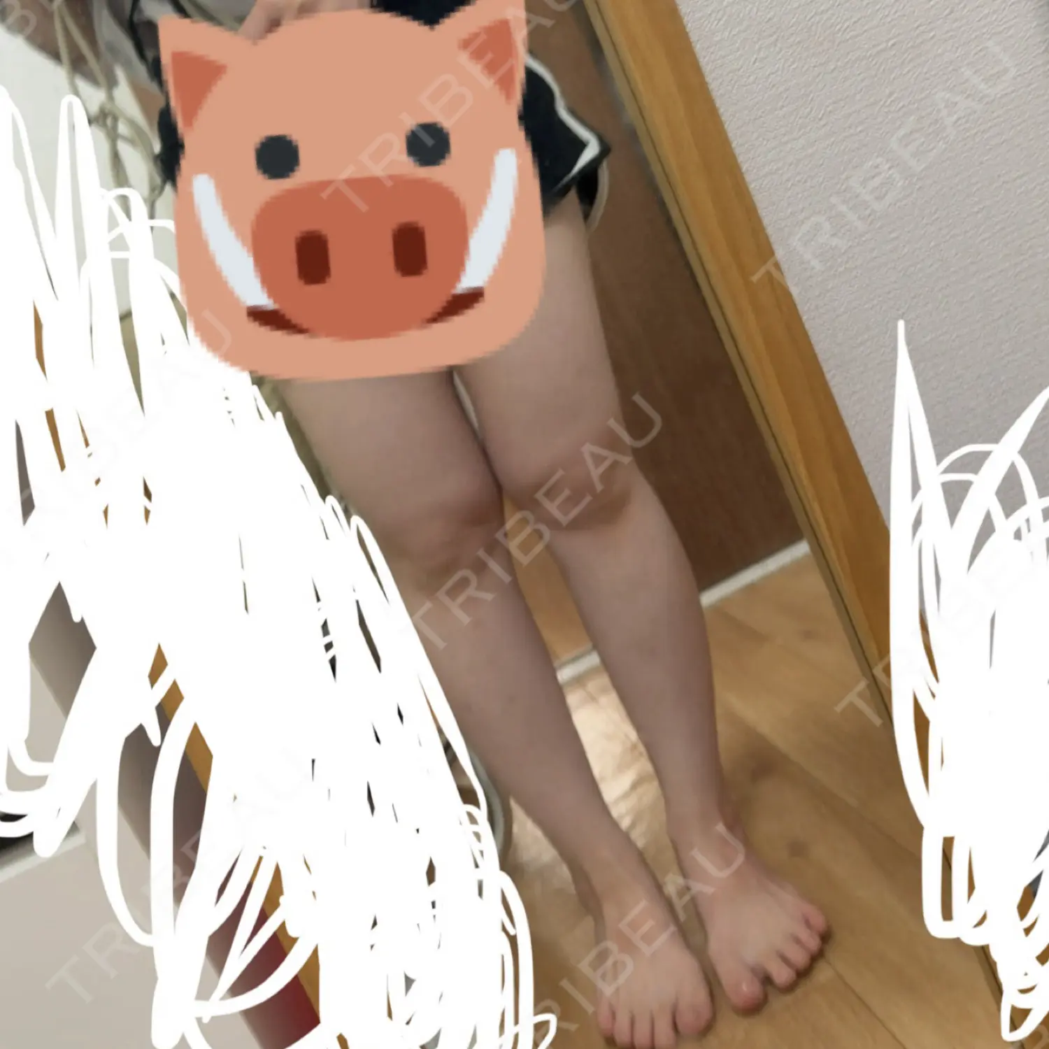 施術後の写真