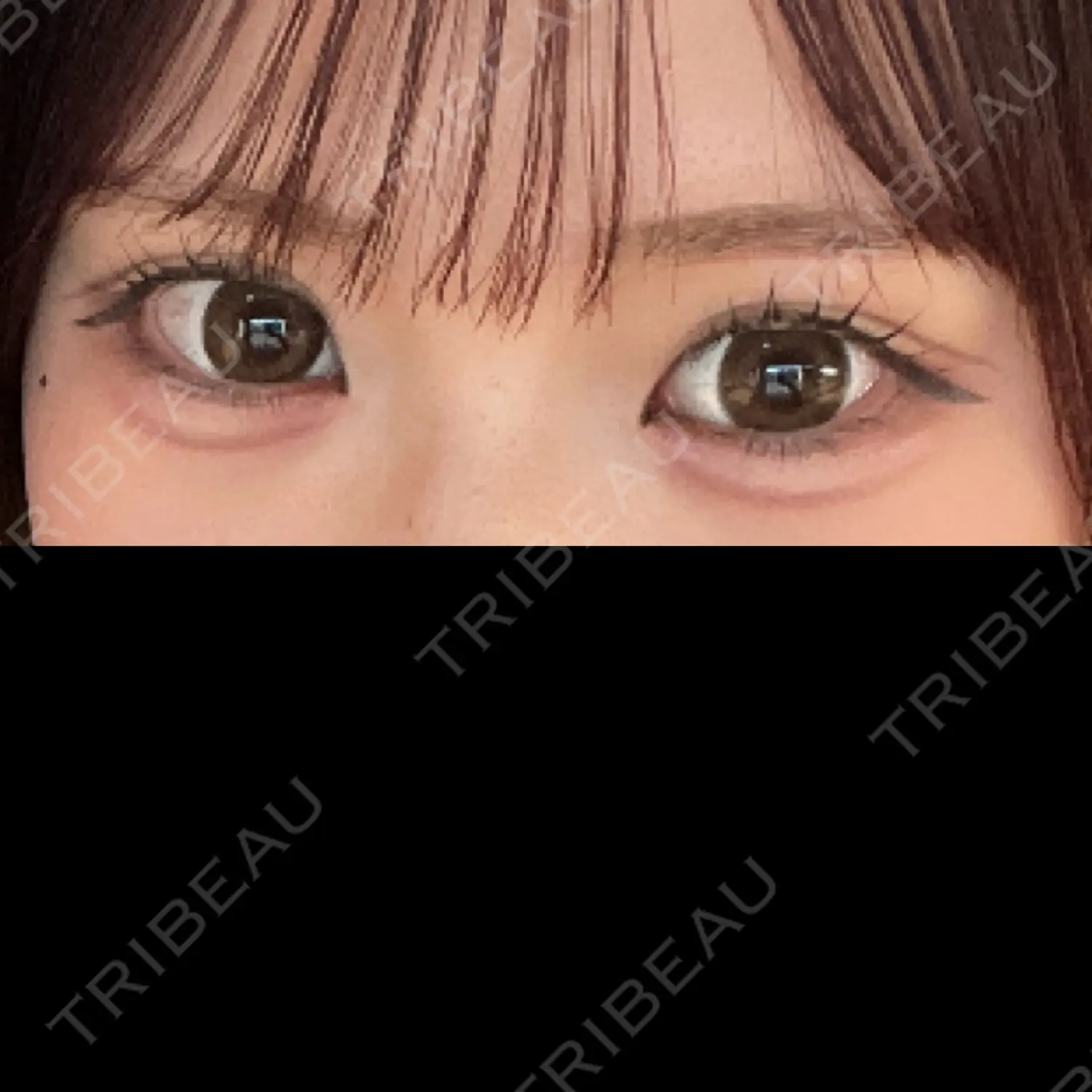 施術後の写真