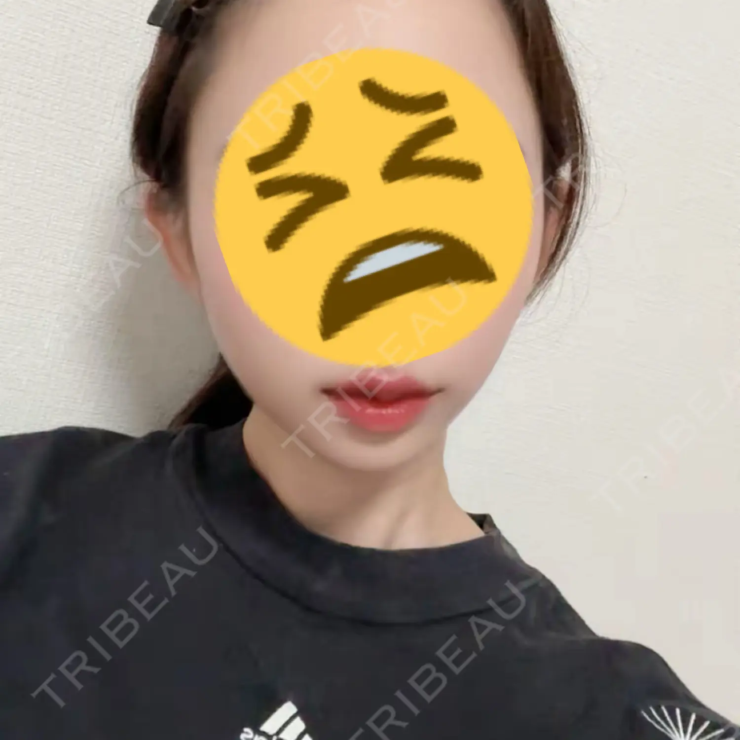 施術後の写真