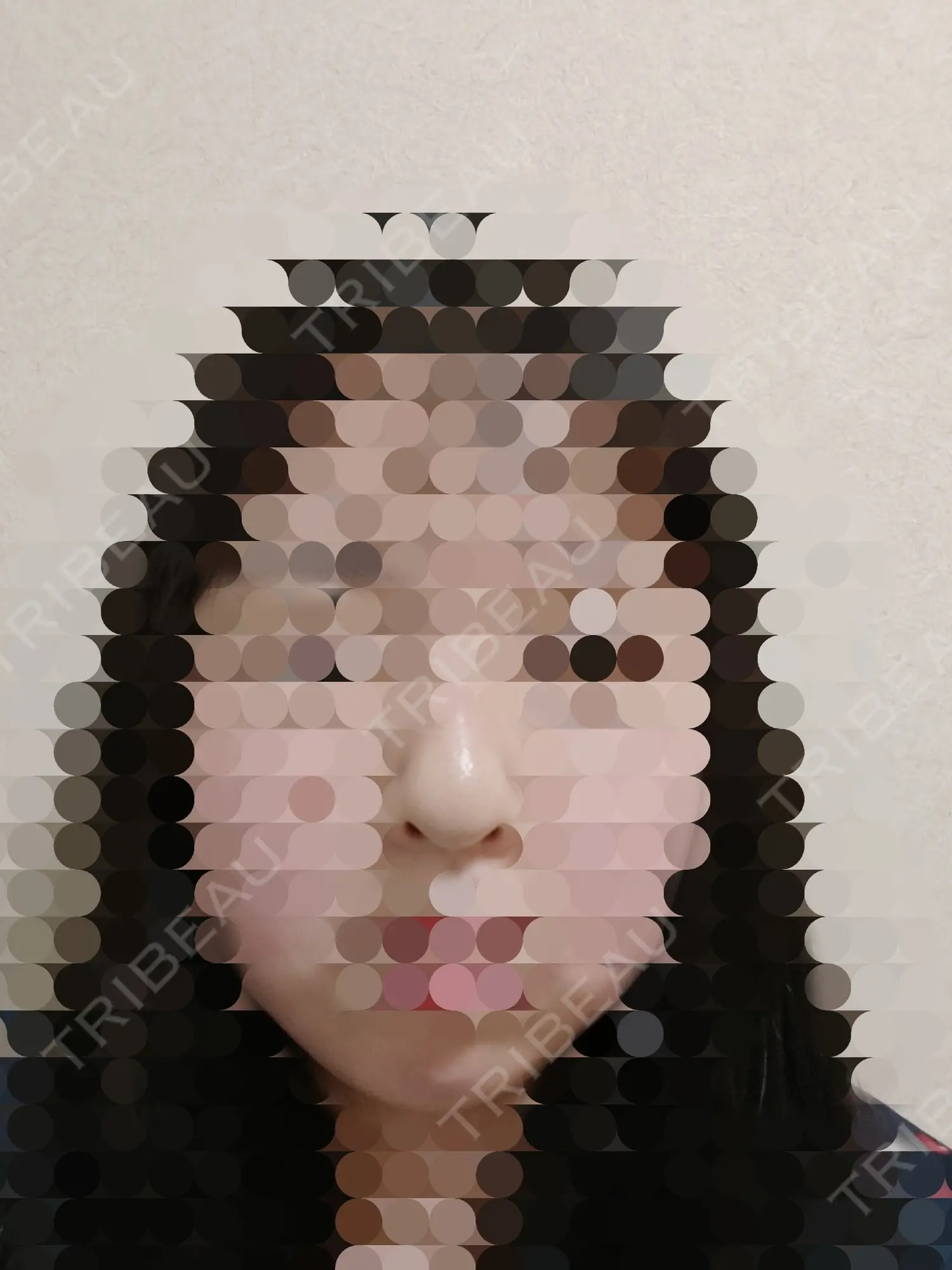 施術後の写真