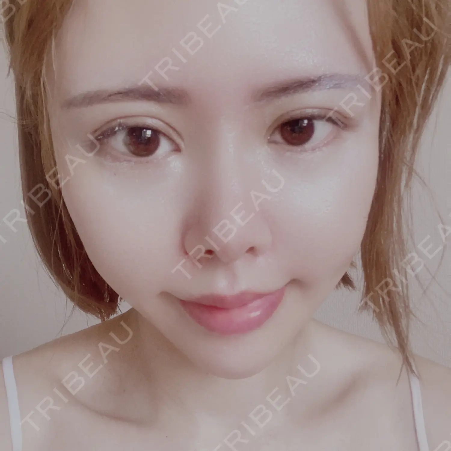 施術後の写真