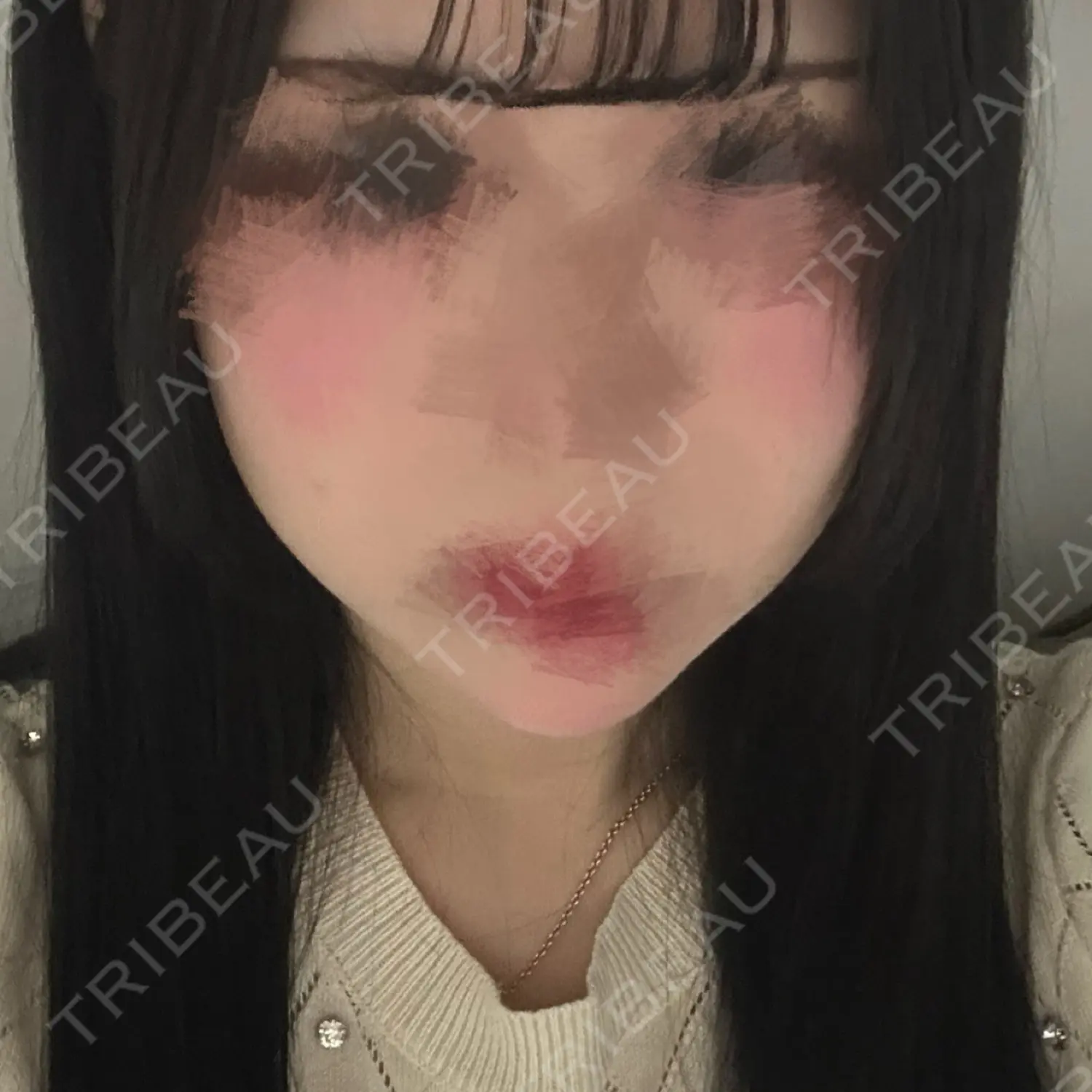 施術後の写真