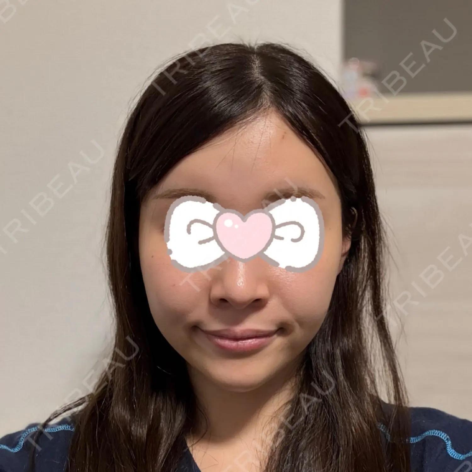 施術後の写真