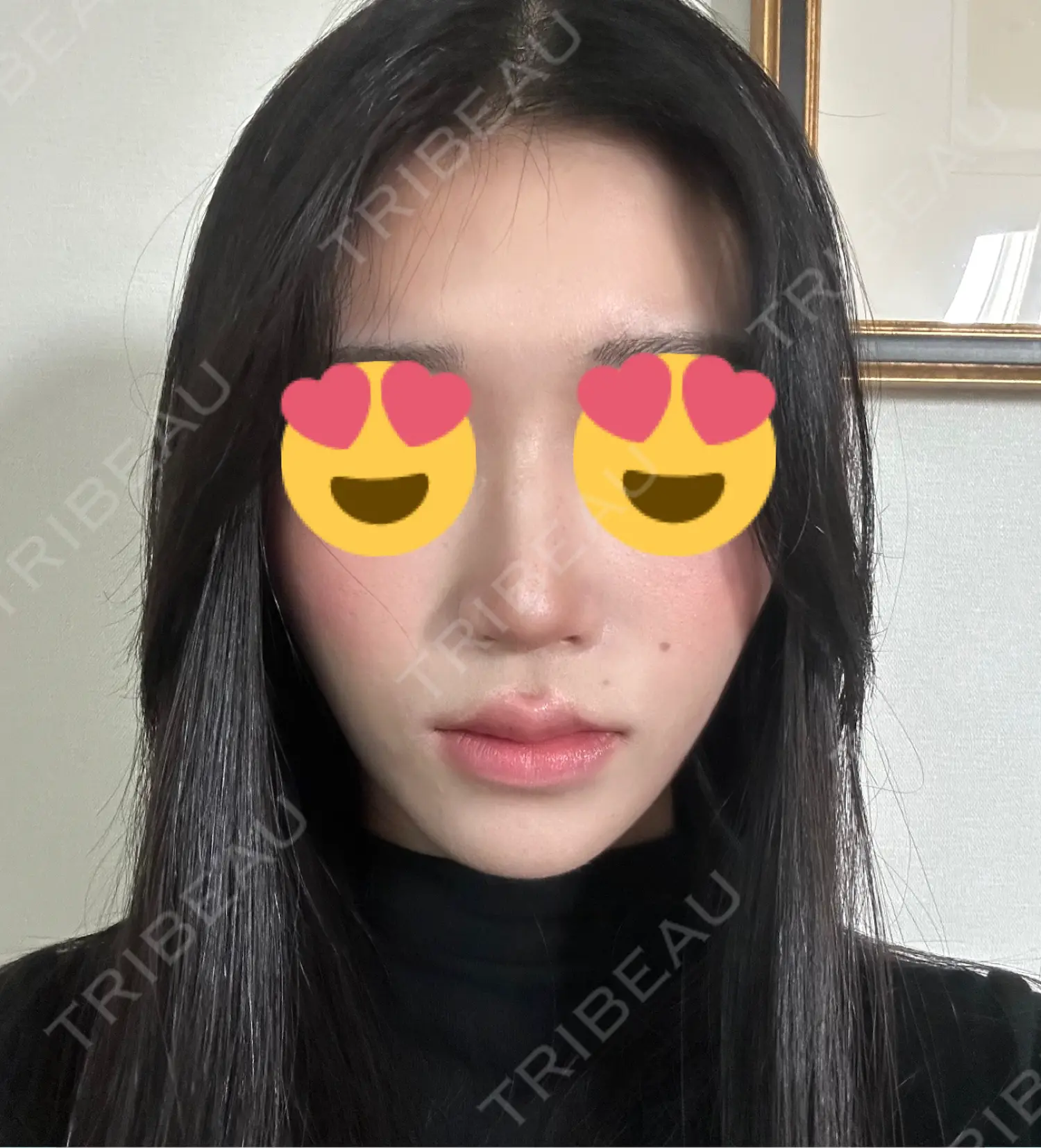 施術後の写真