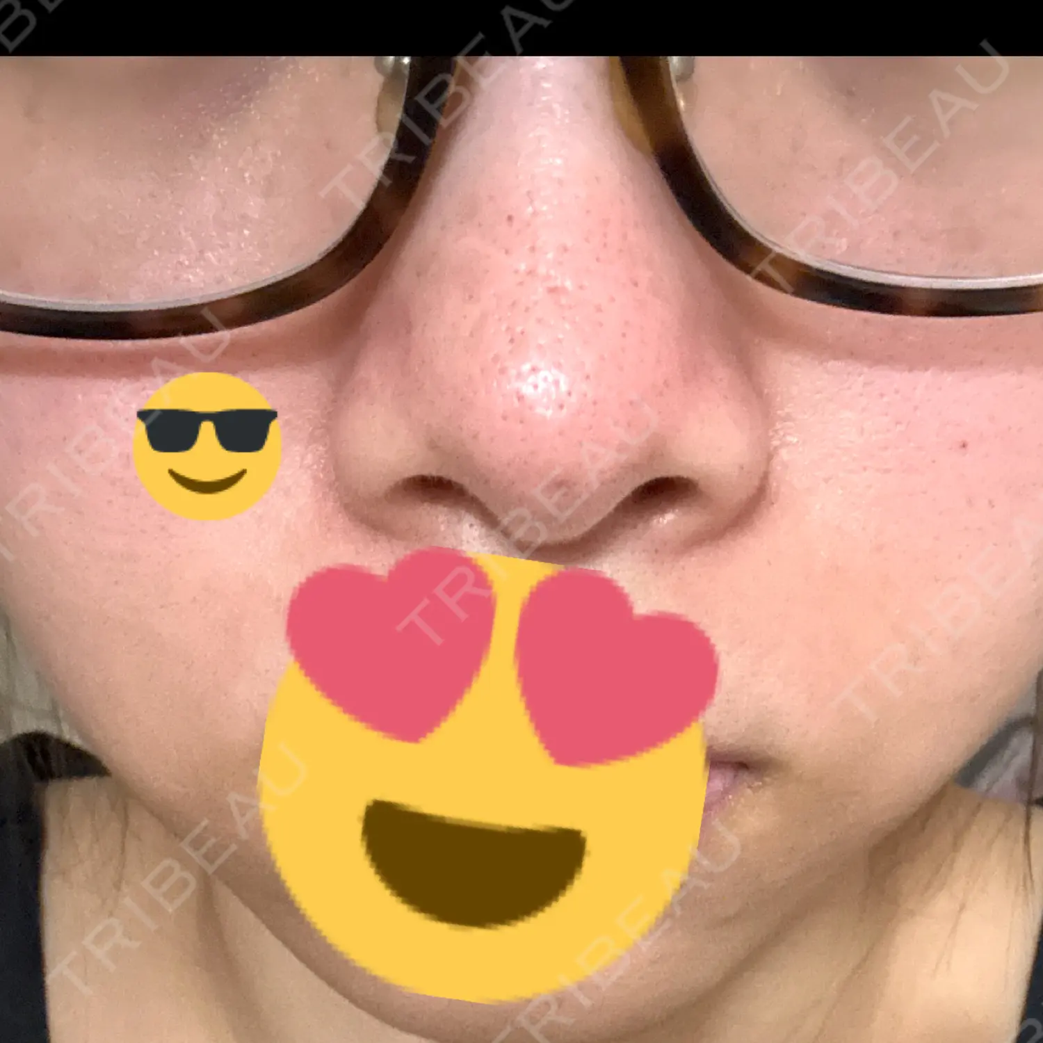 施術後の写真
