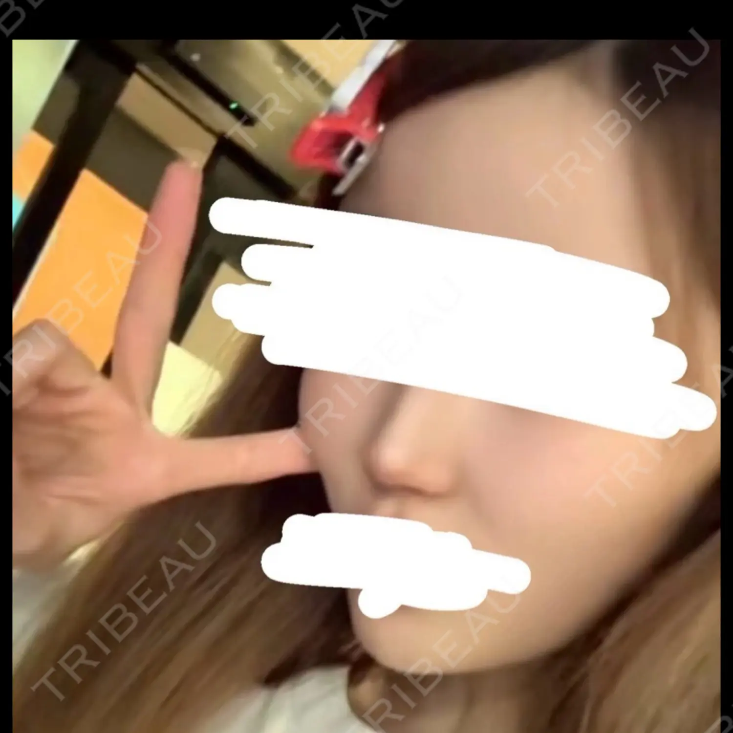 施術後の写真