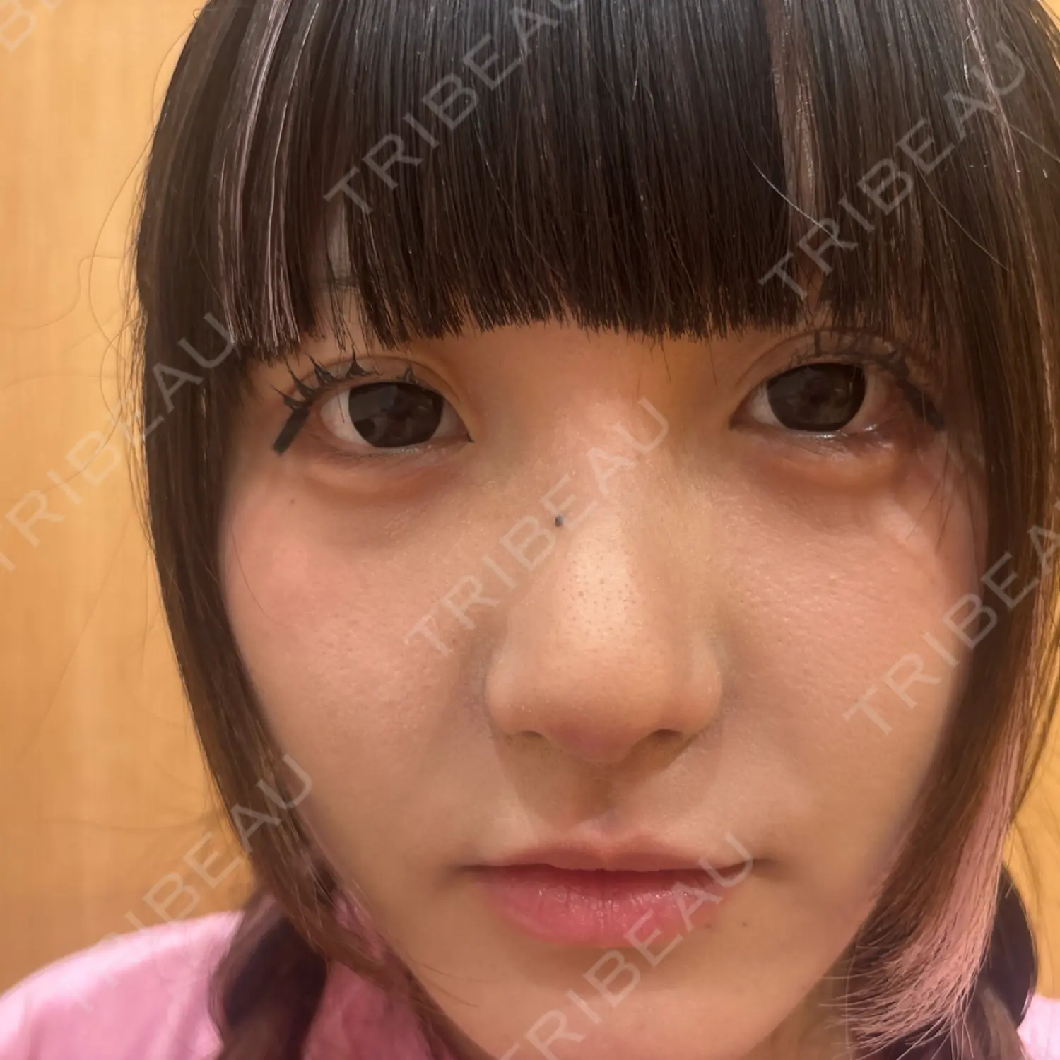 施術後の写真