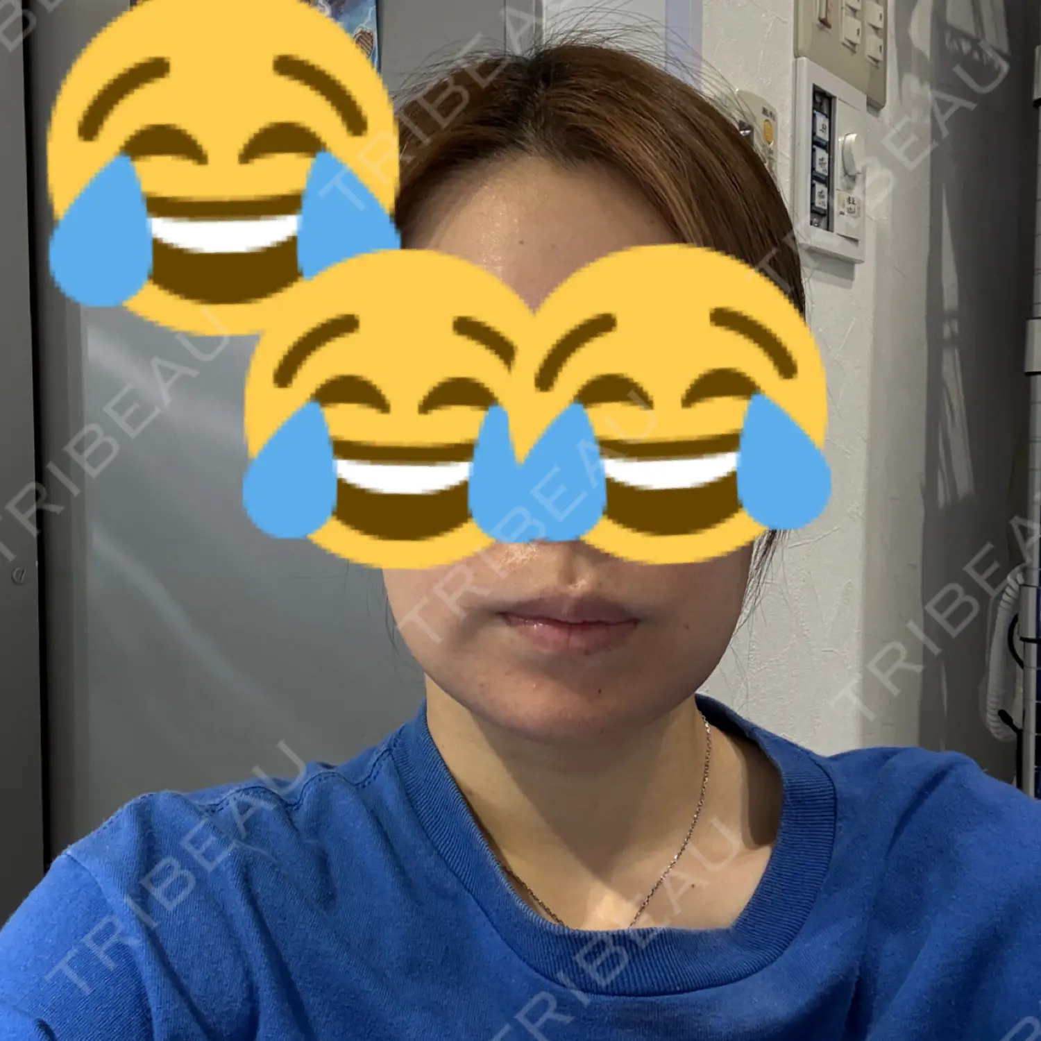 施術後の写真