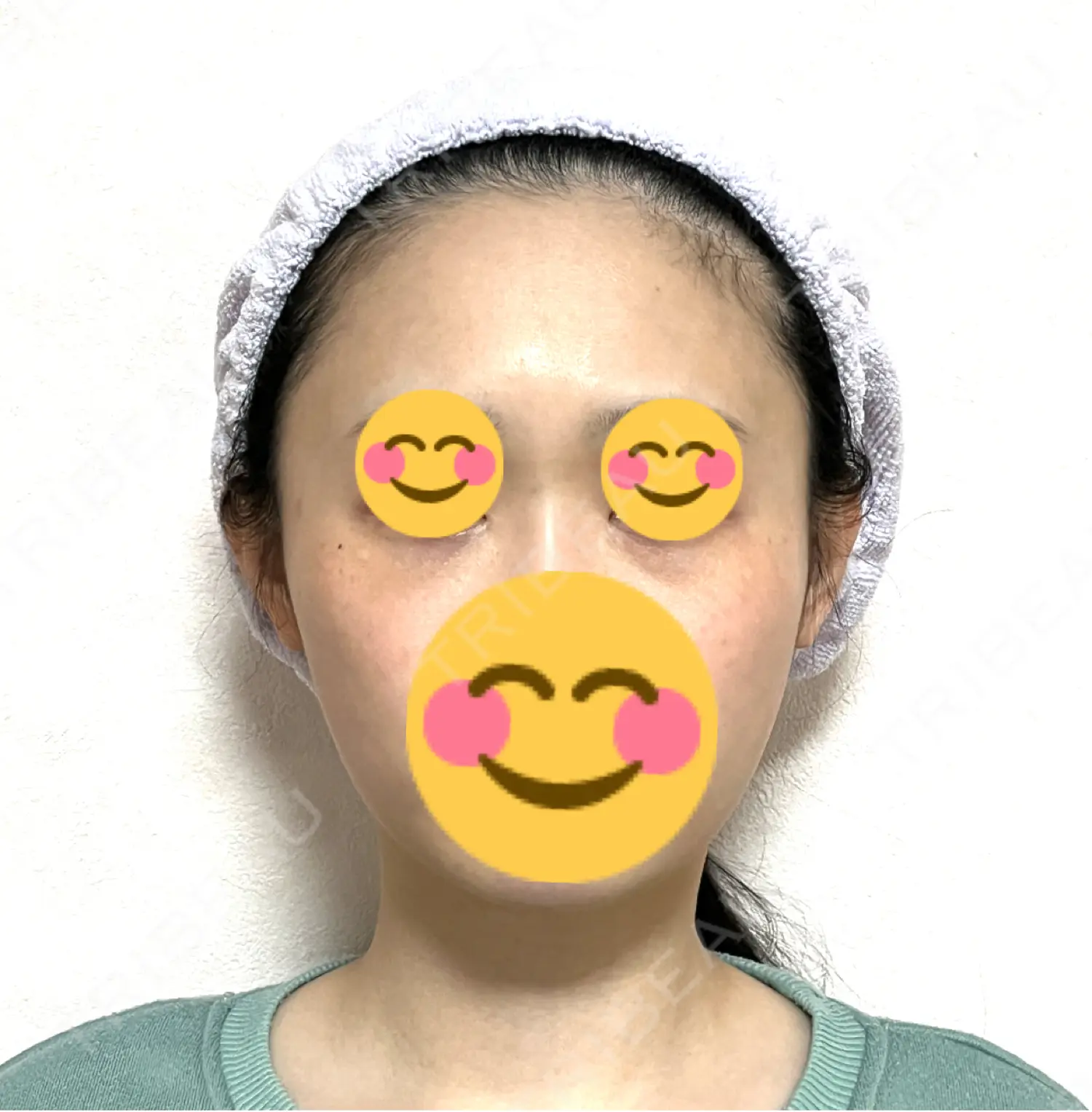施術後の写真