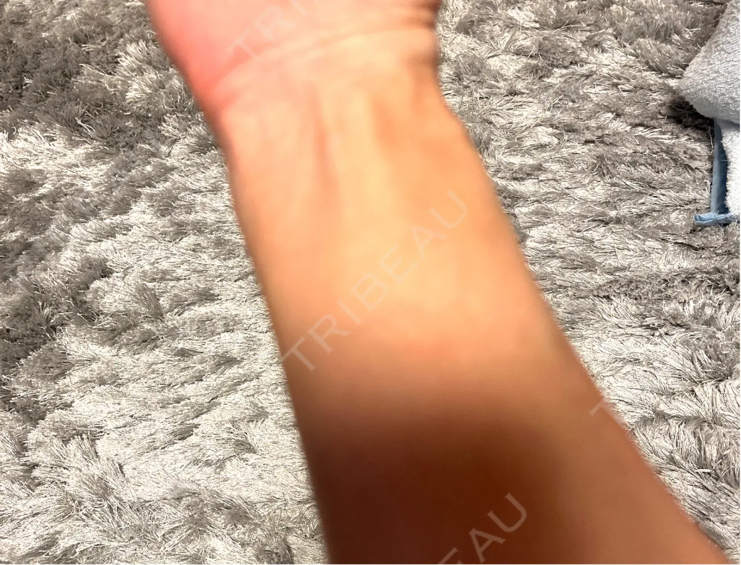 施術後の写真