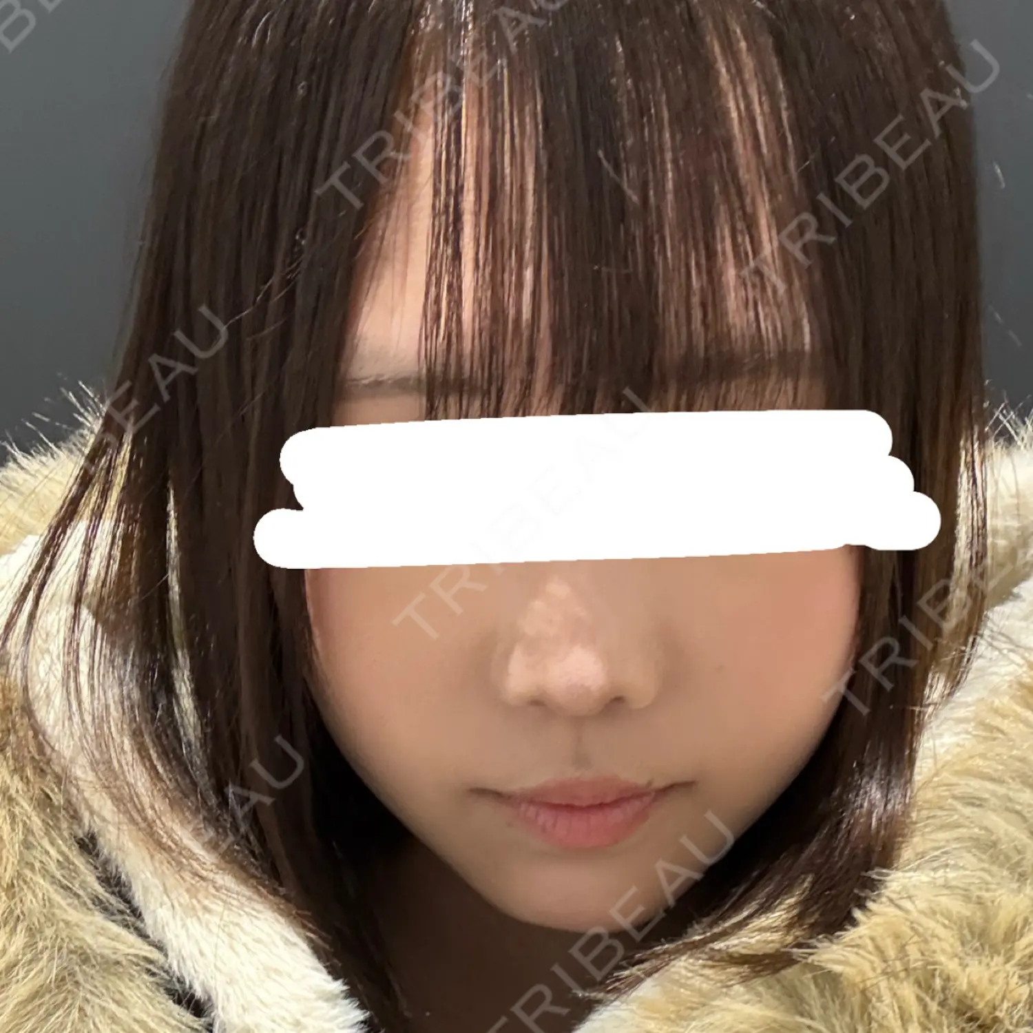 施術後の写真