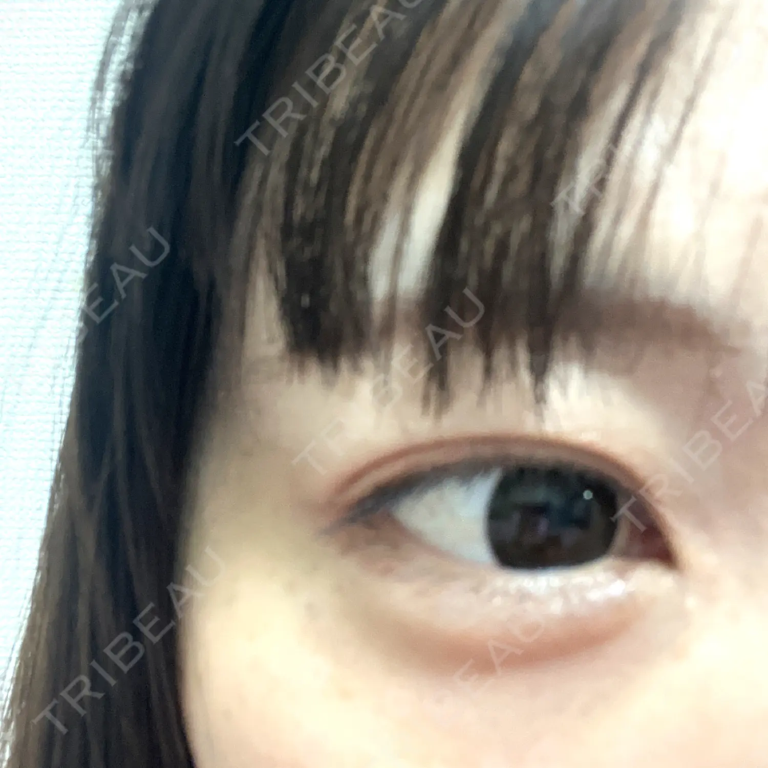 施術後の写真