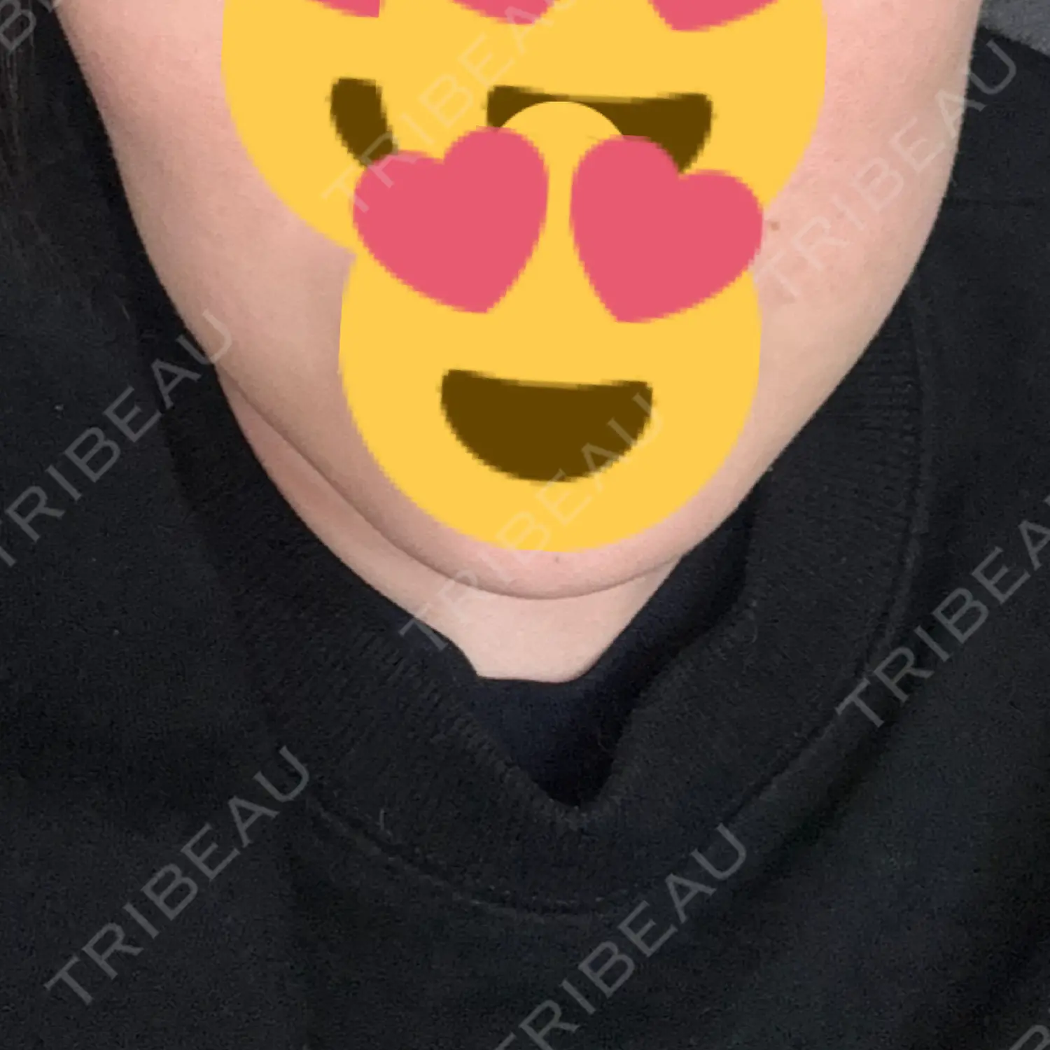 施術後の写真