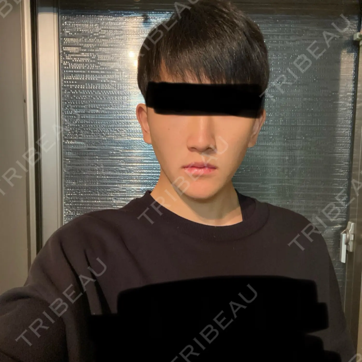施術後の写真