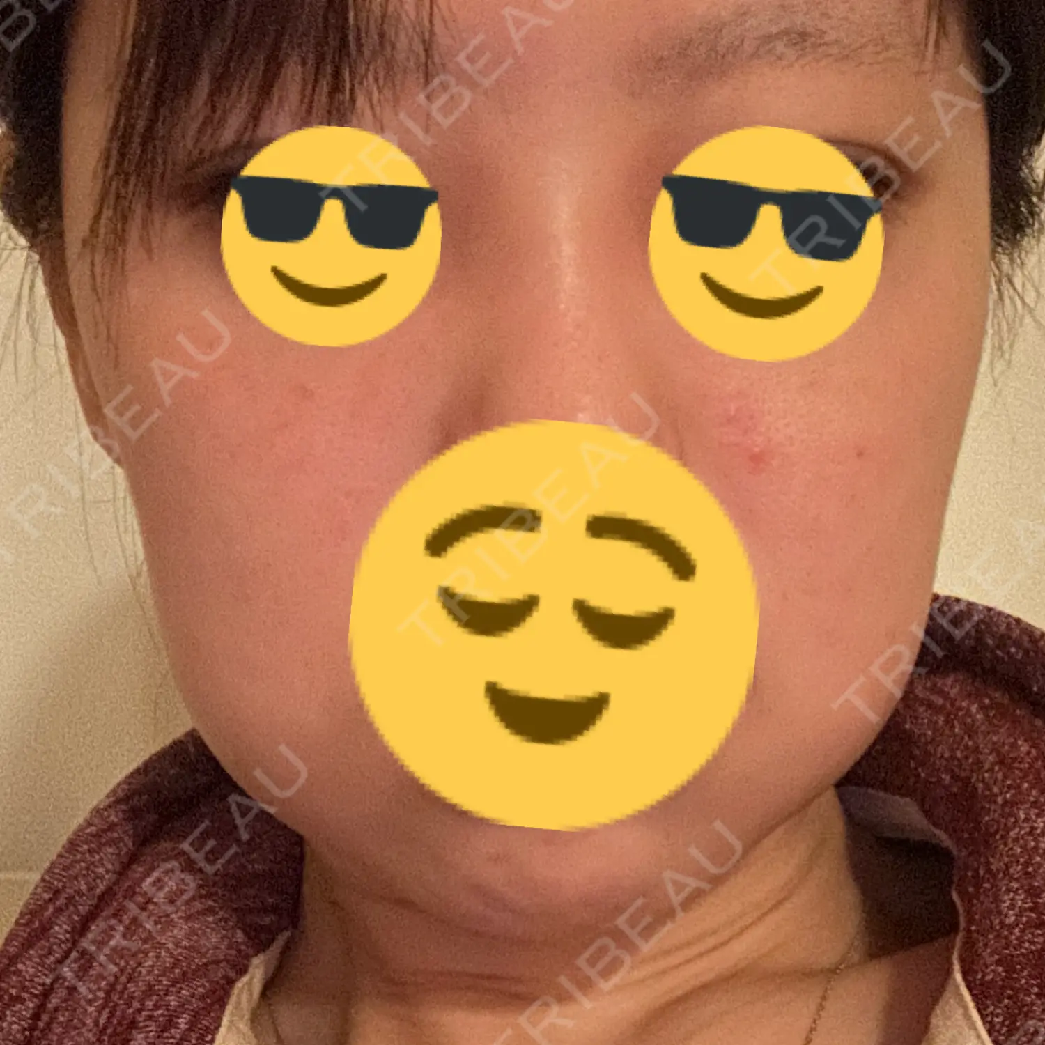 施術後の写真