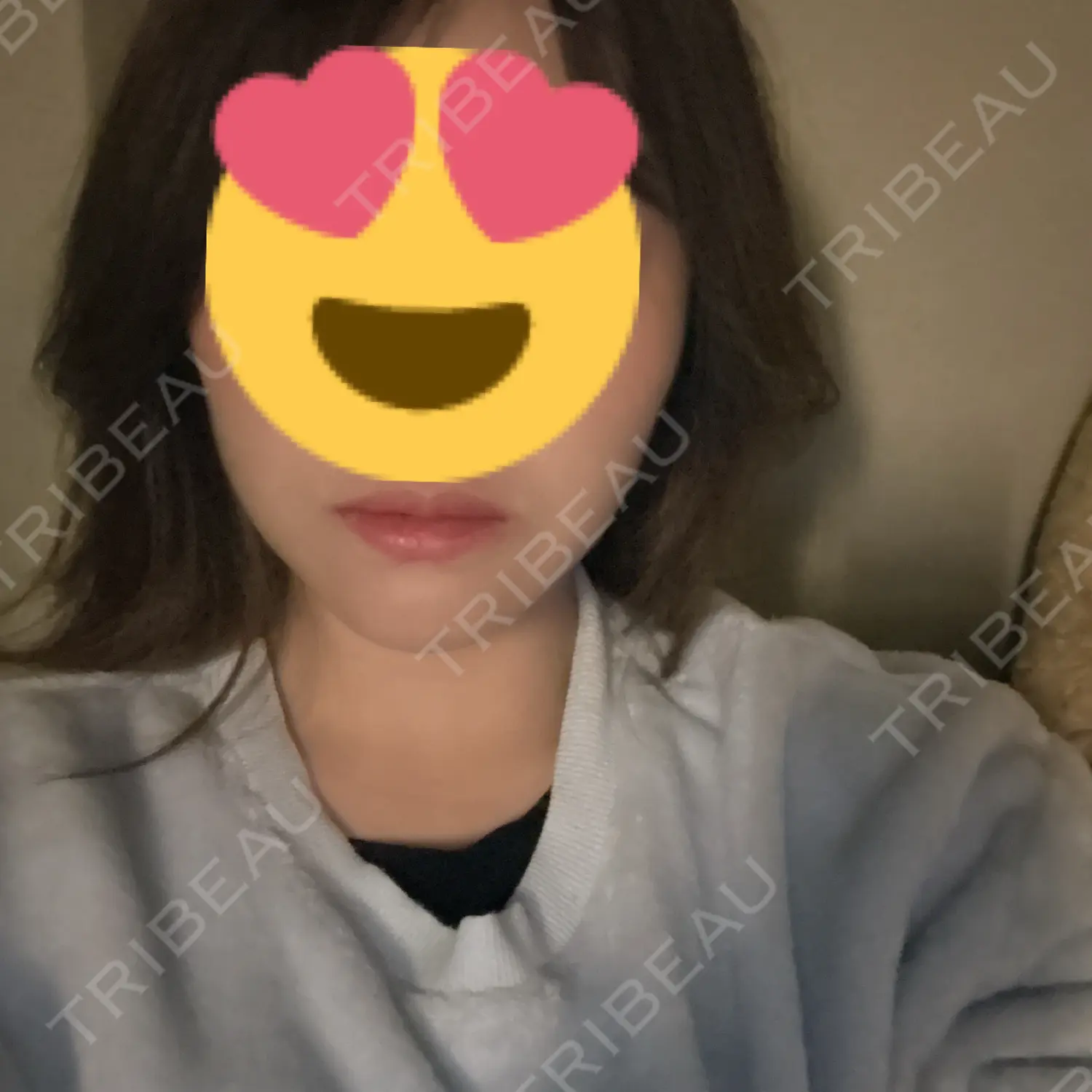施術後の写真