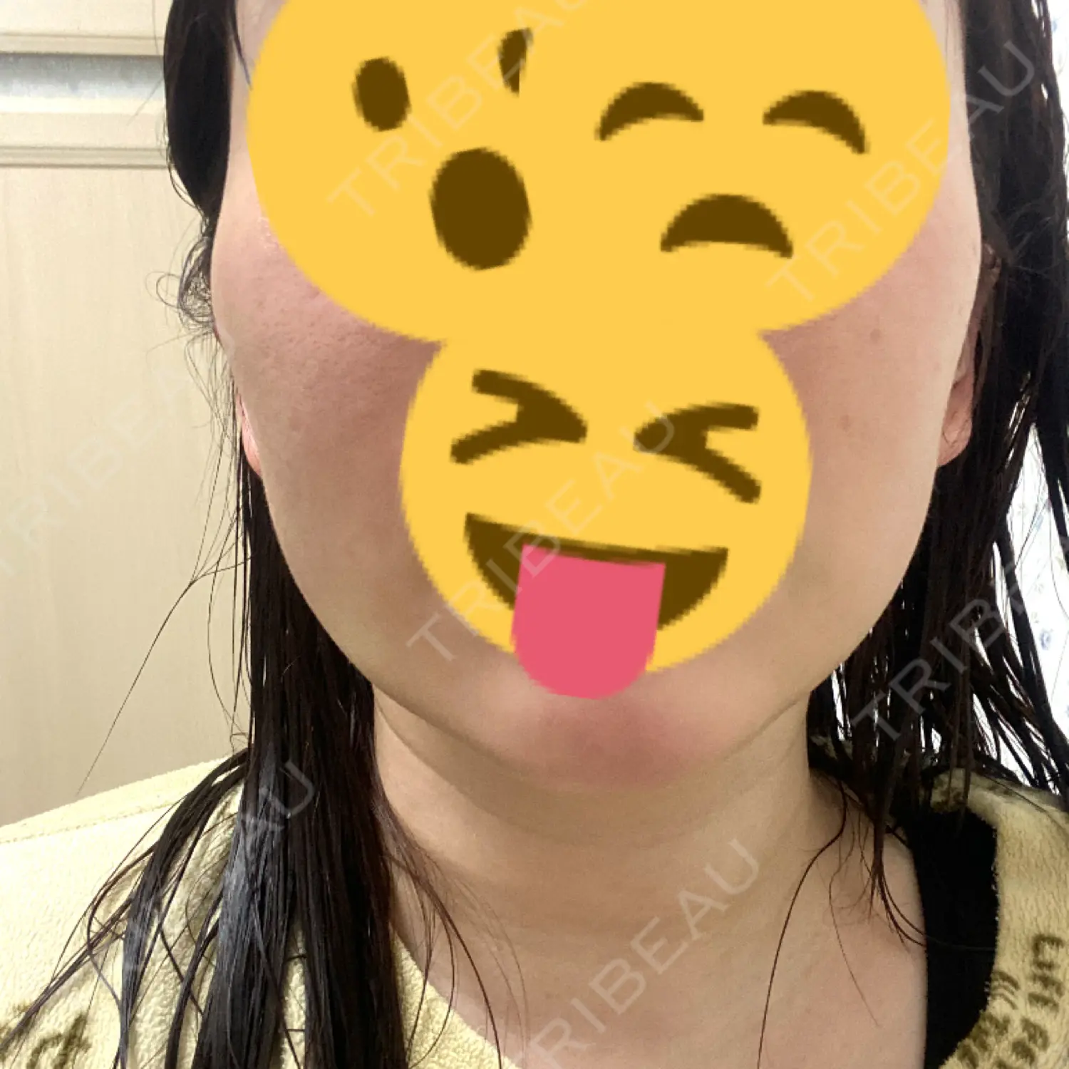 施術後の写真