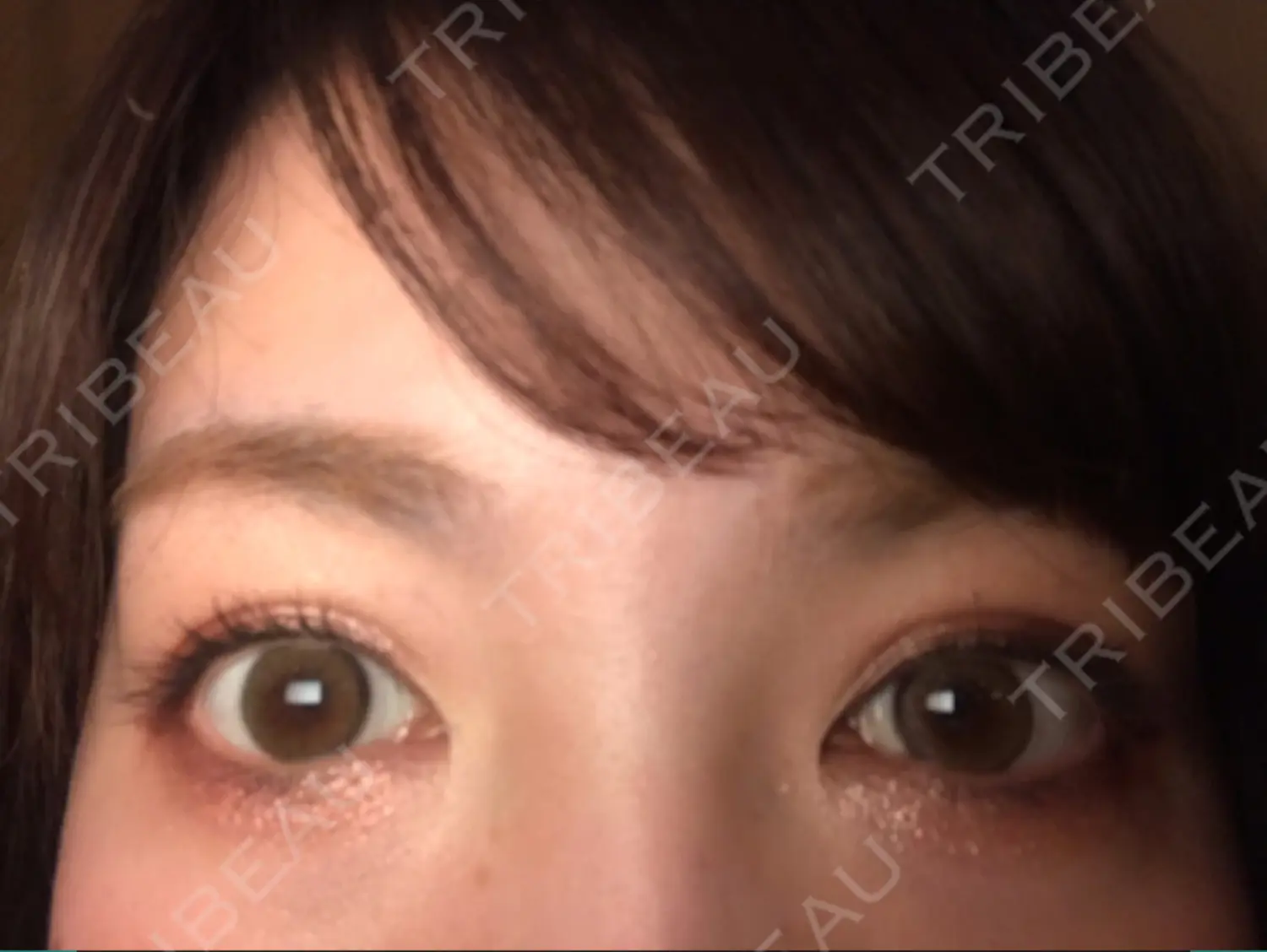 施術後の写真