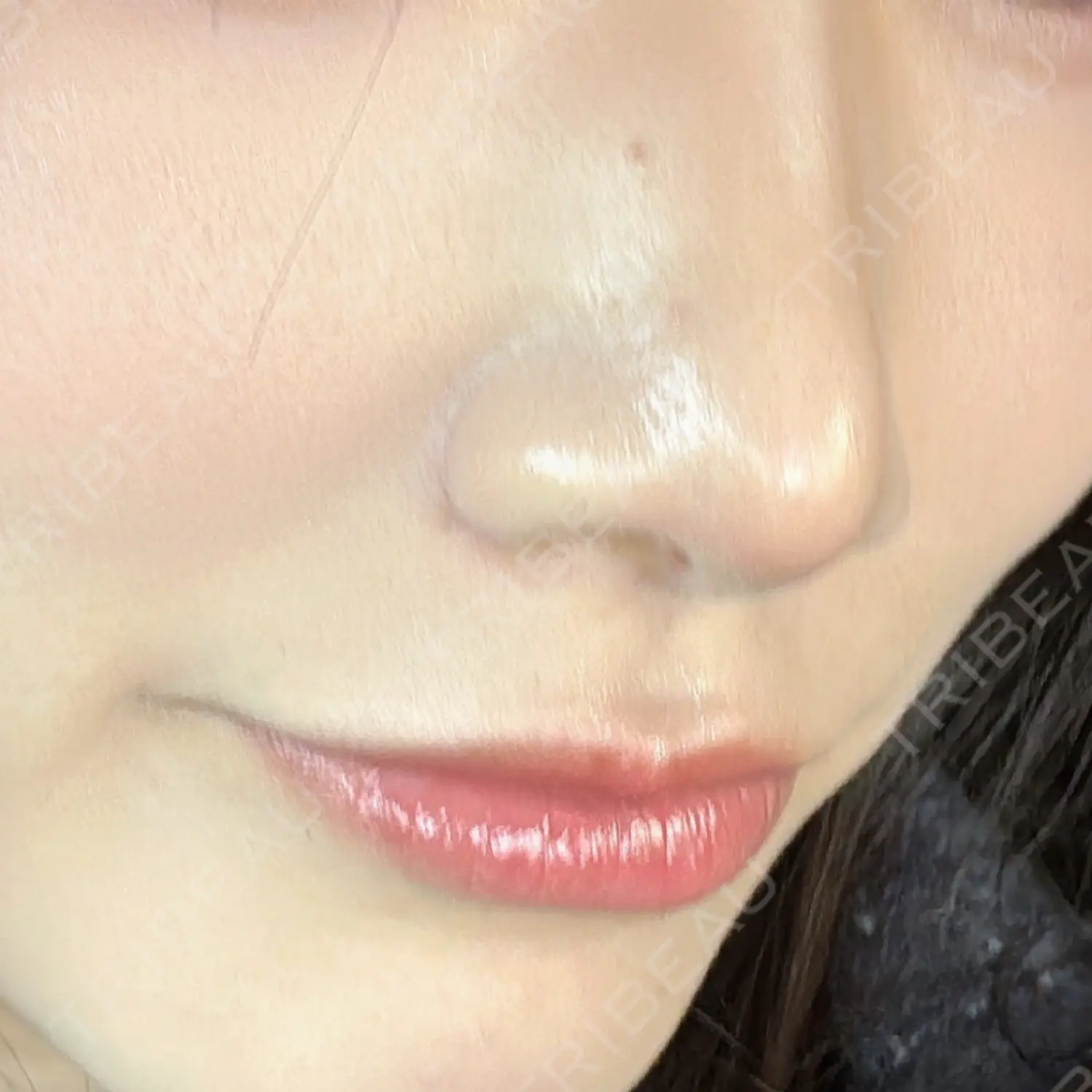 施術後の写真