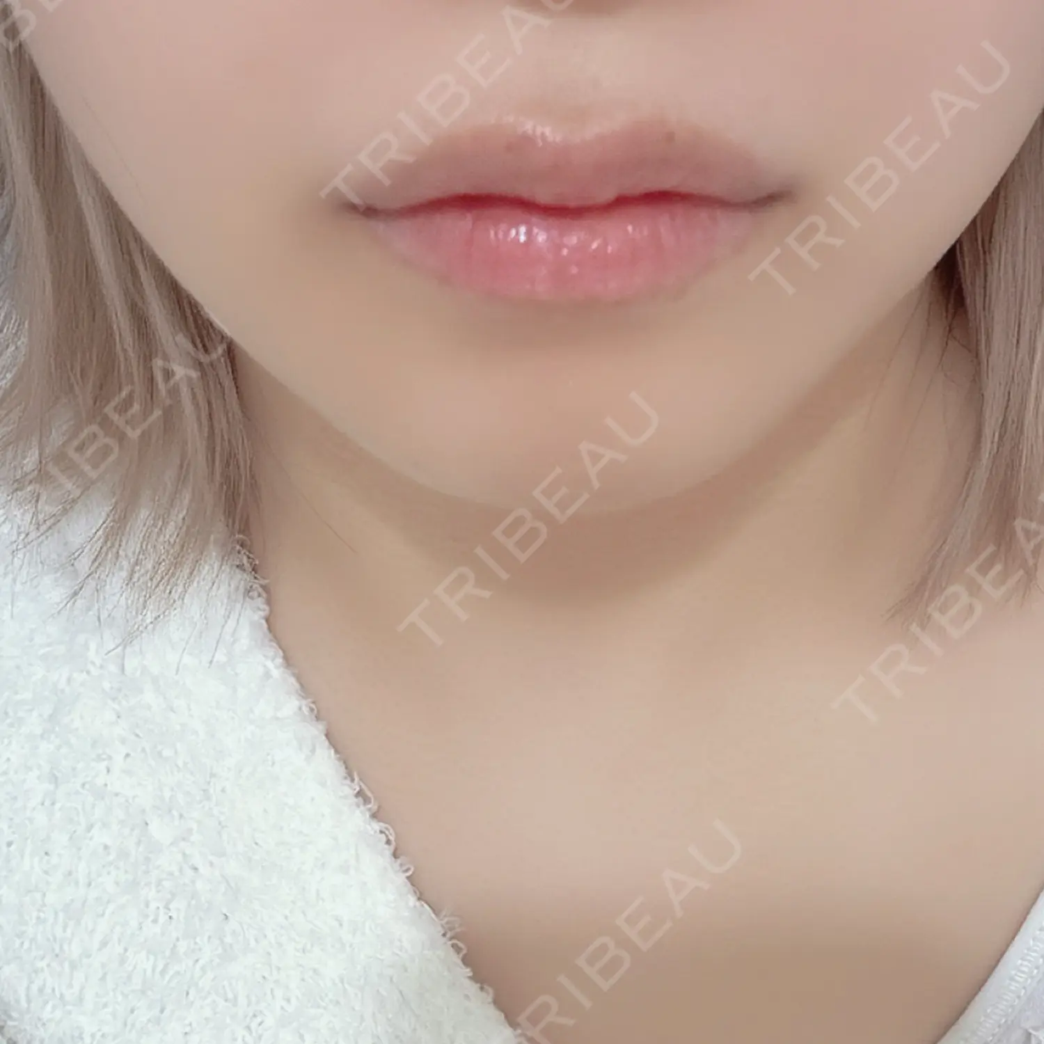 施術後の写真