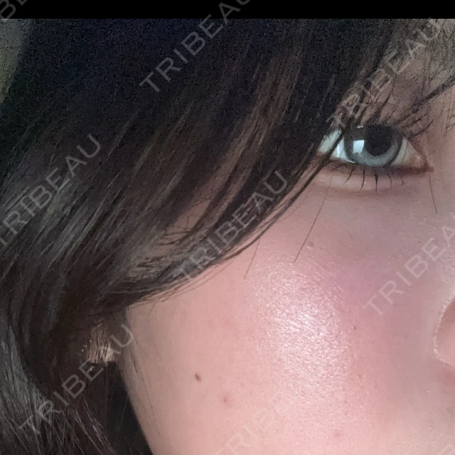 施術後の写真