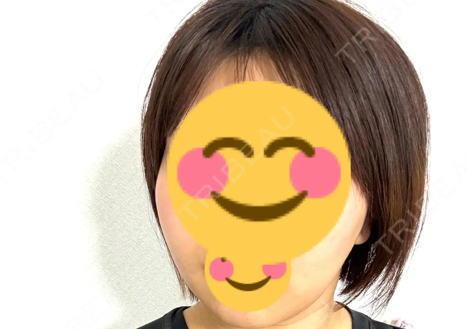 施術後の写真