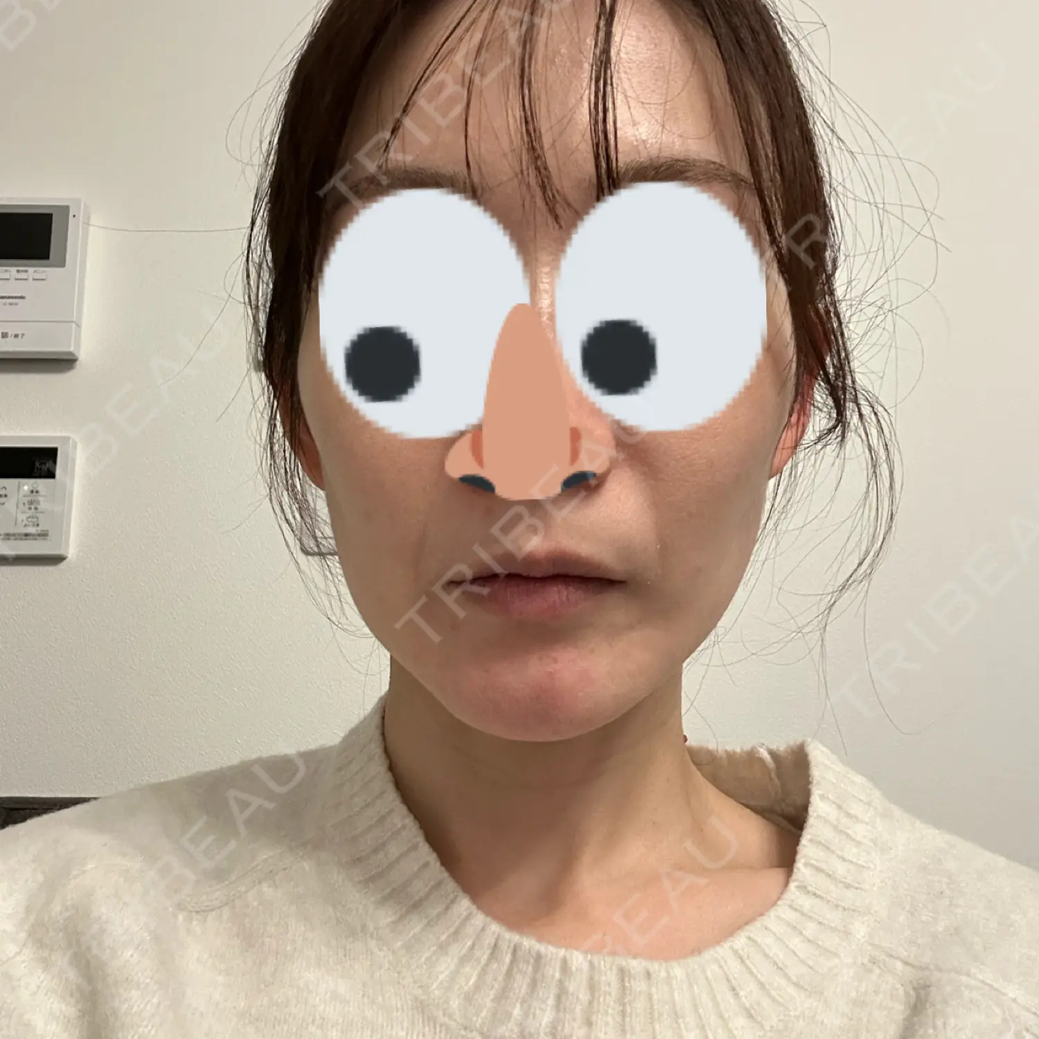 施術後の写真