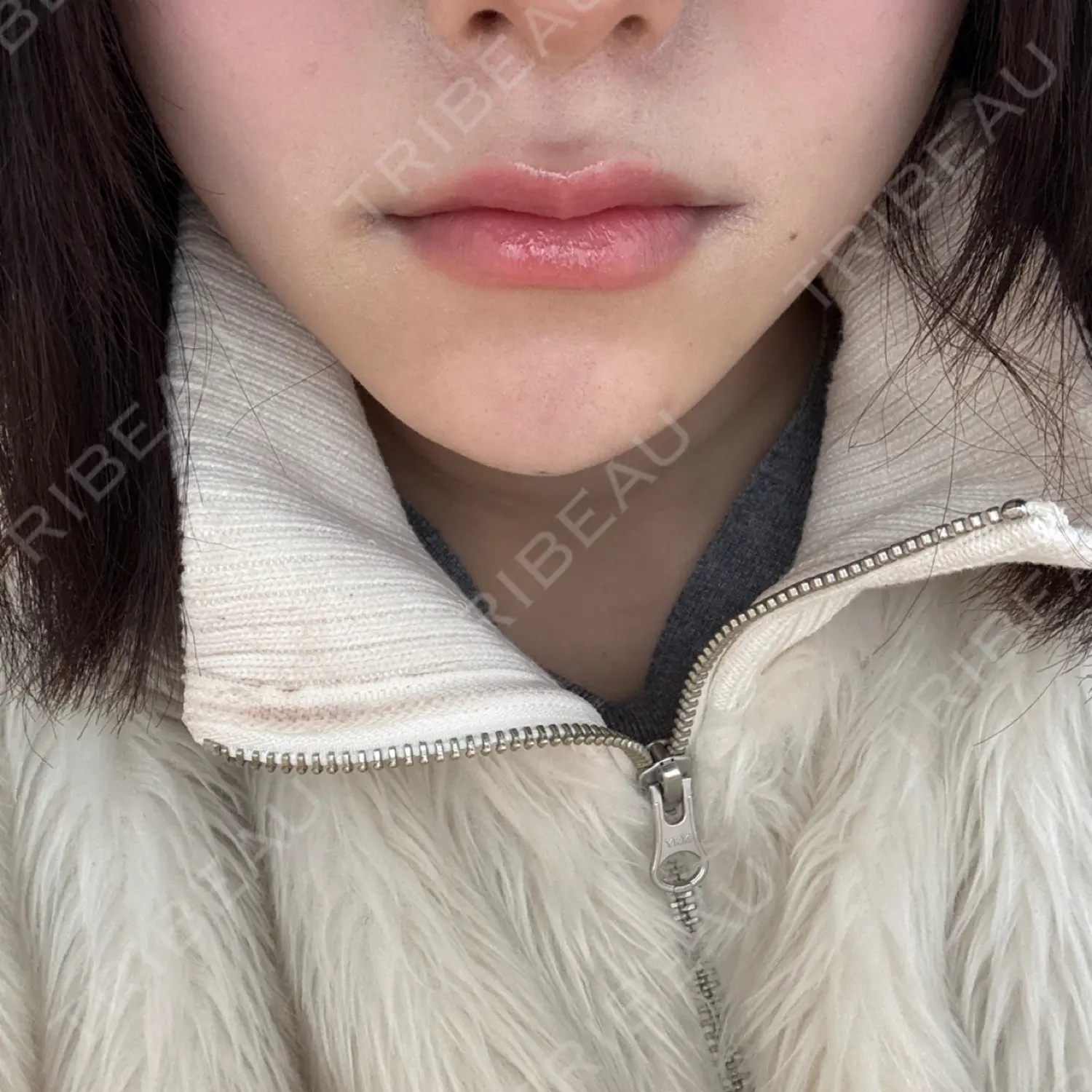 施術後の写真