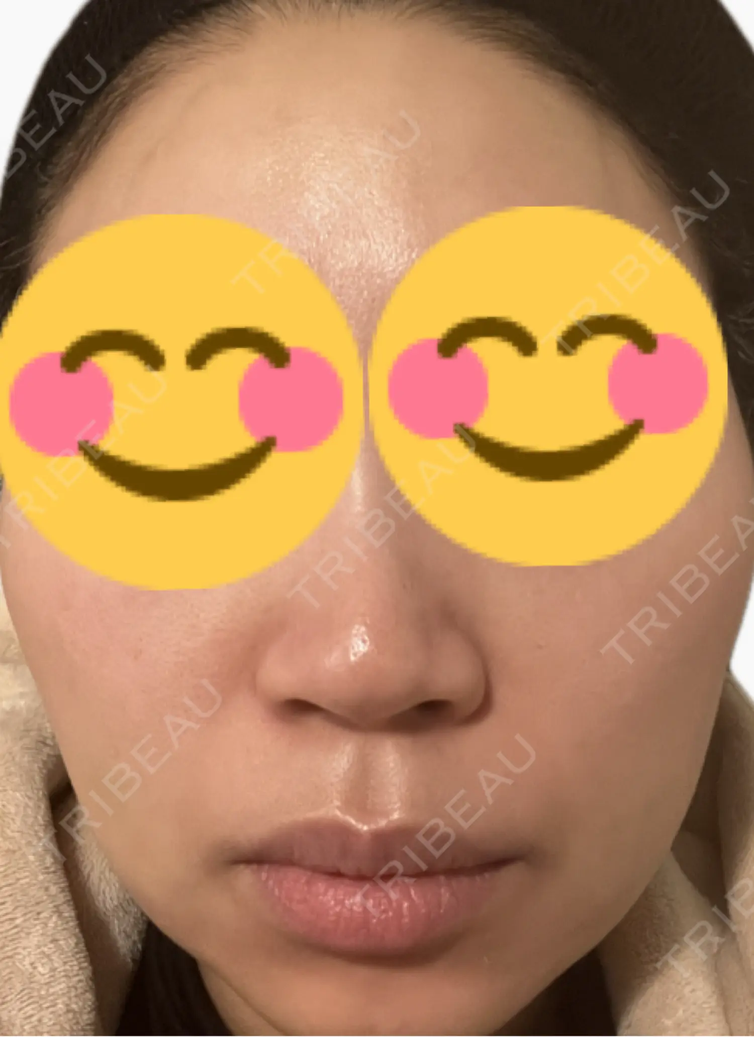 施術後の写真