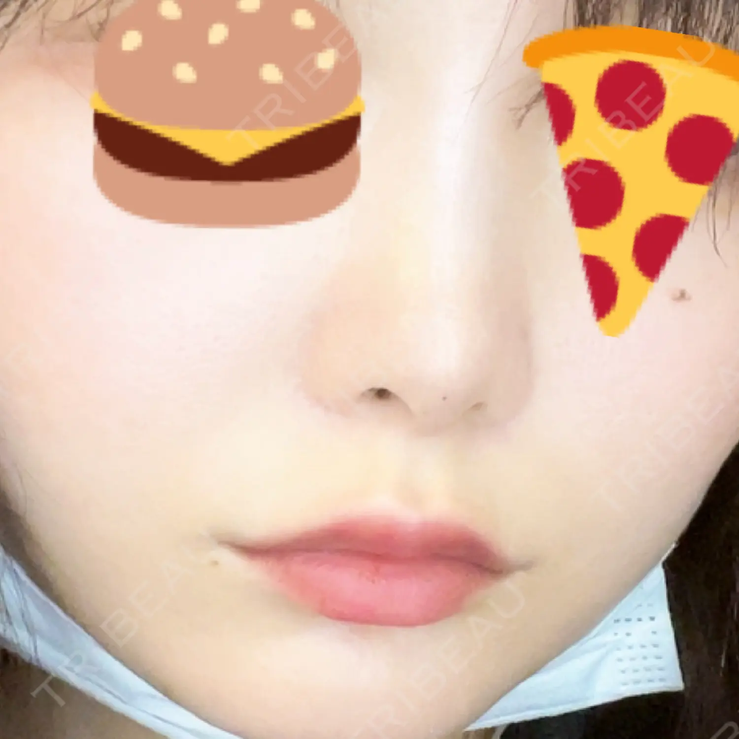 施術後の写真