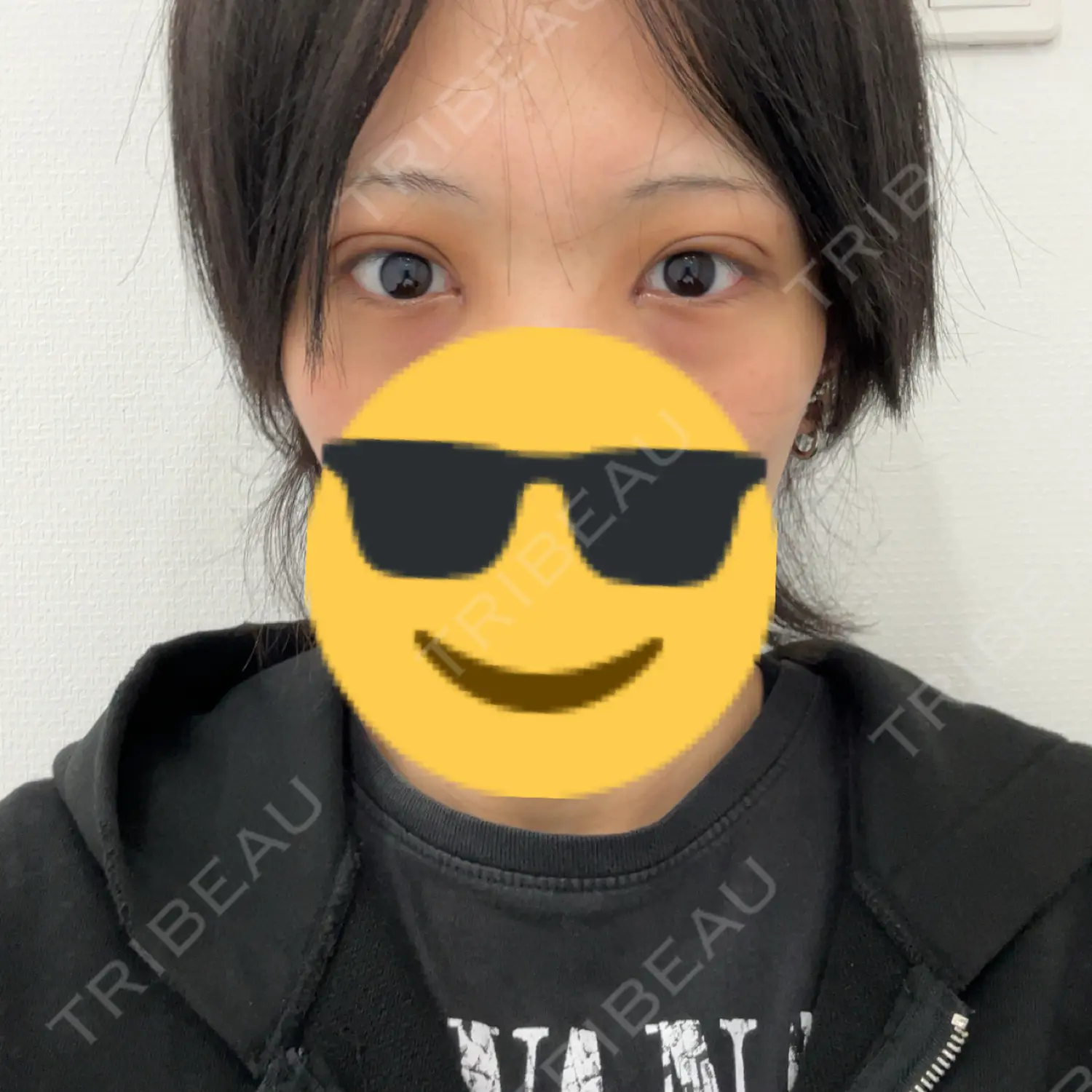 施術後の写真