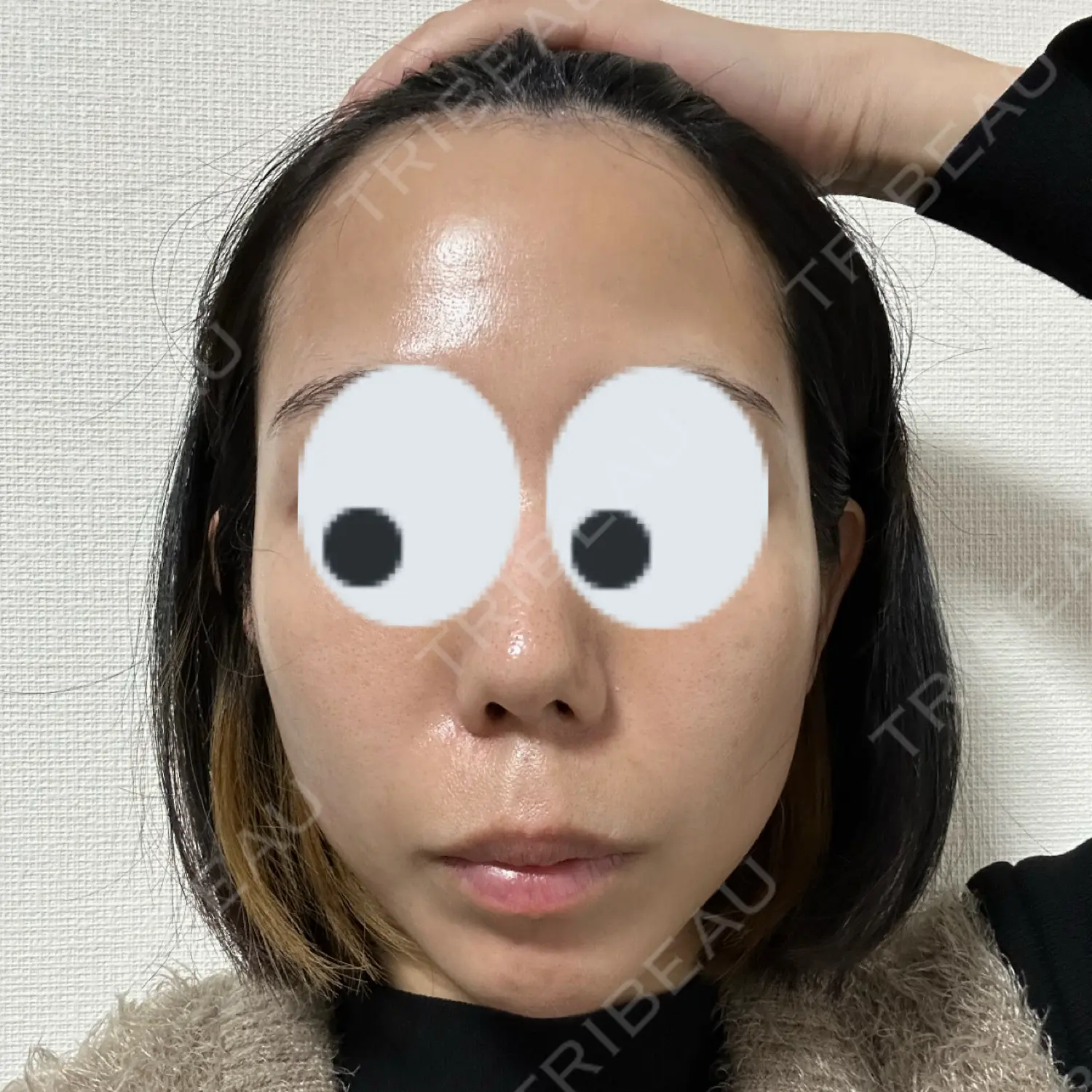 施術後の写真