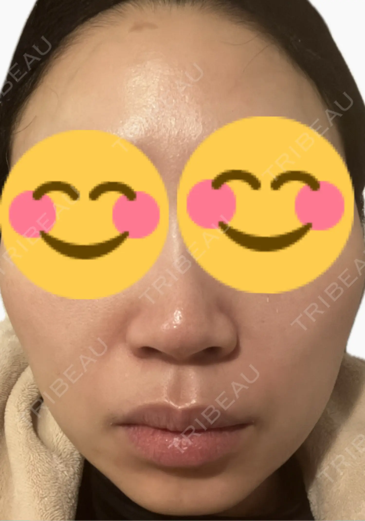 施術後の写真