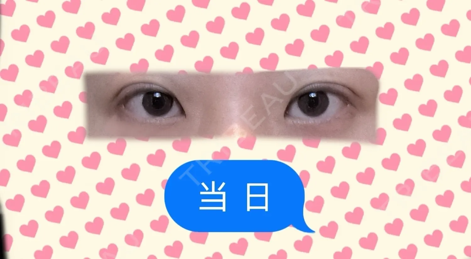 施術後の写真
