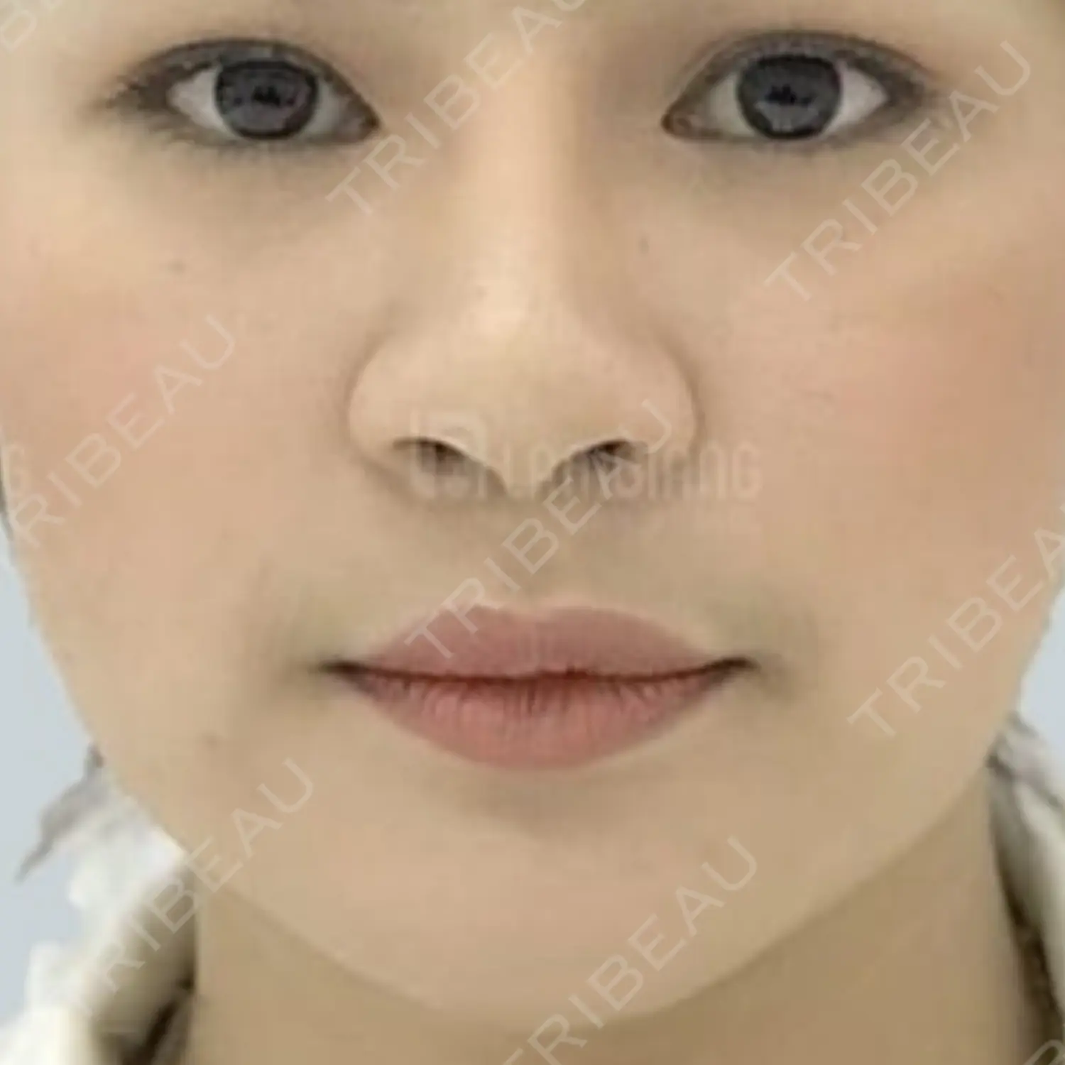 施術後の写真