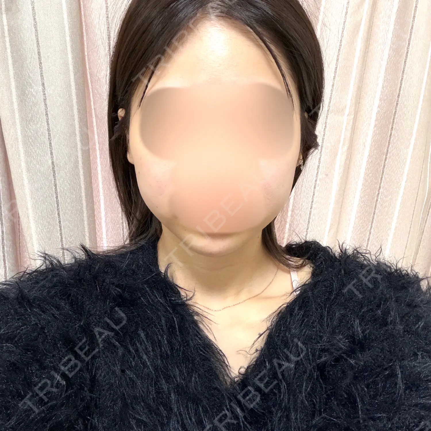 施術後の写真