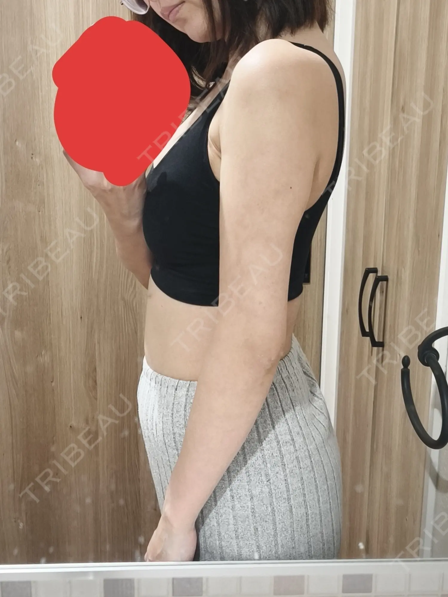 施術後の写真