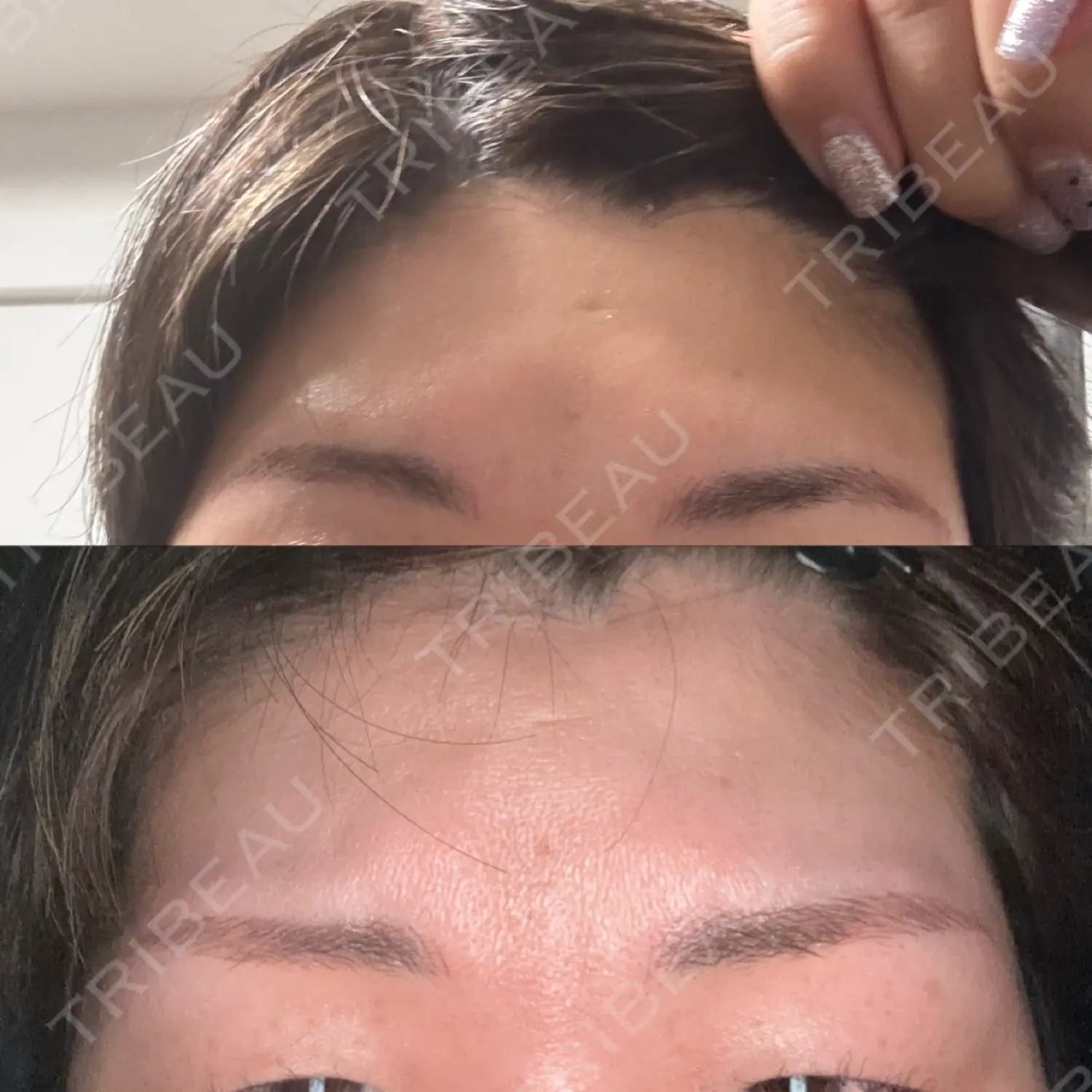 施術後の写真