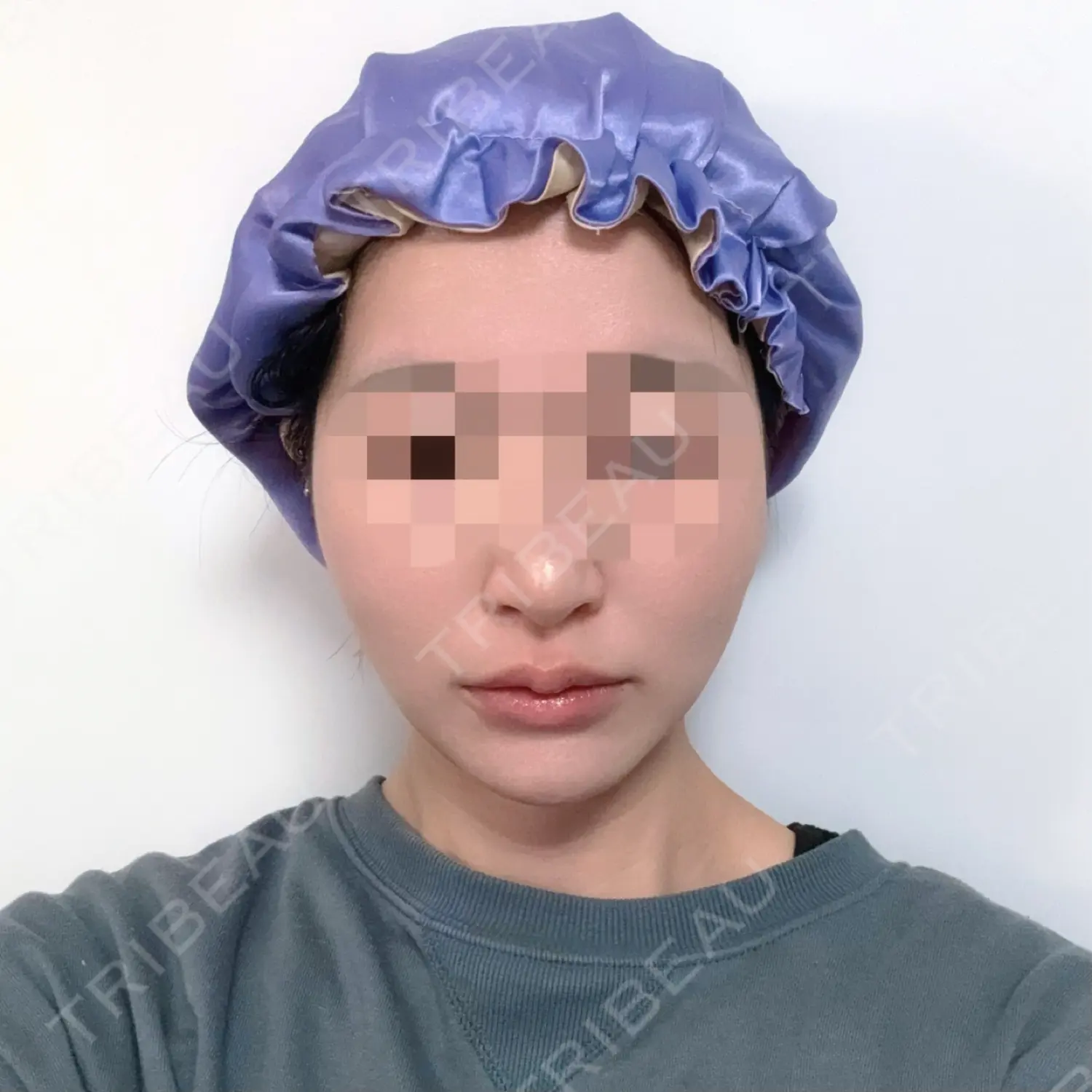 施術後の写真