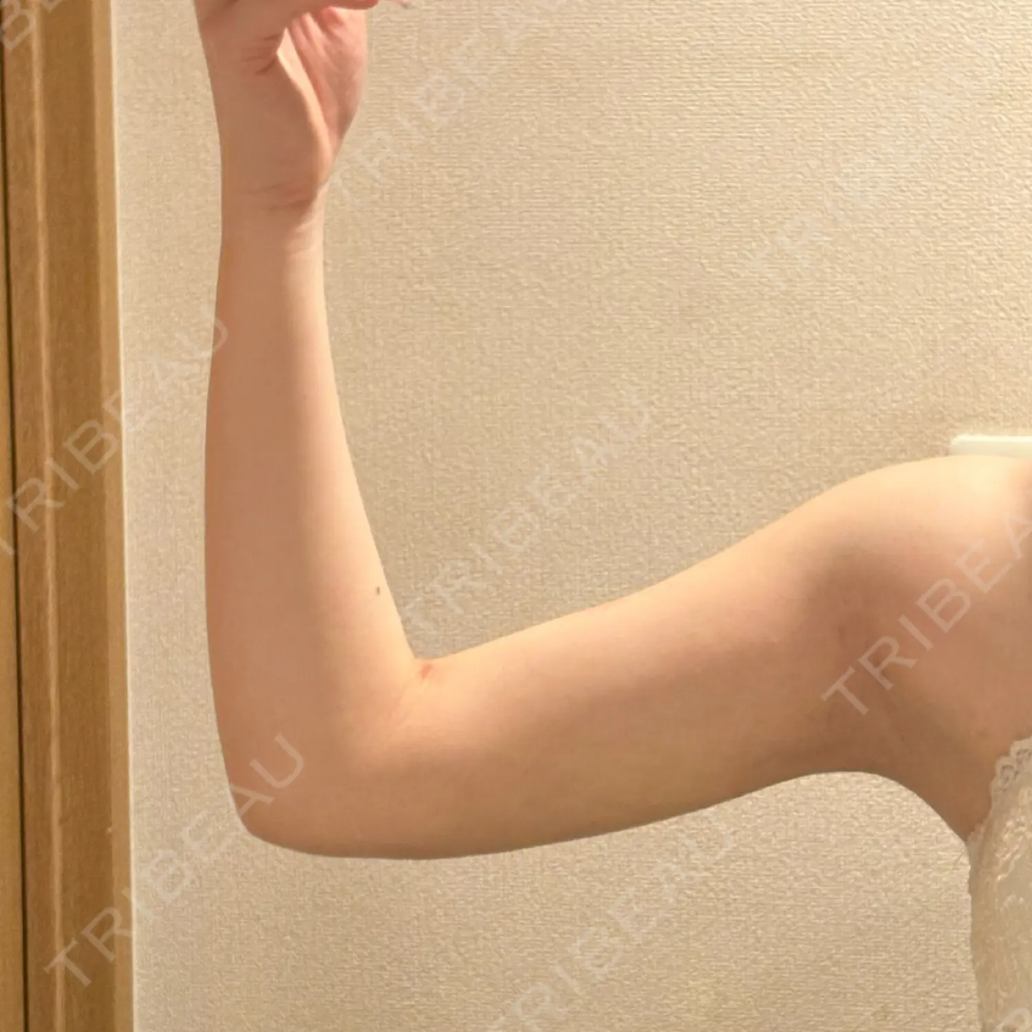 施術後の写真