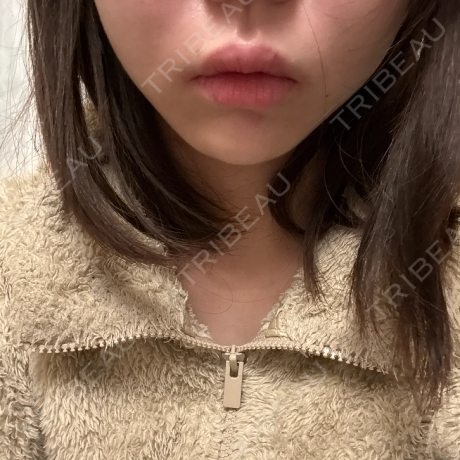 施術後の写真