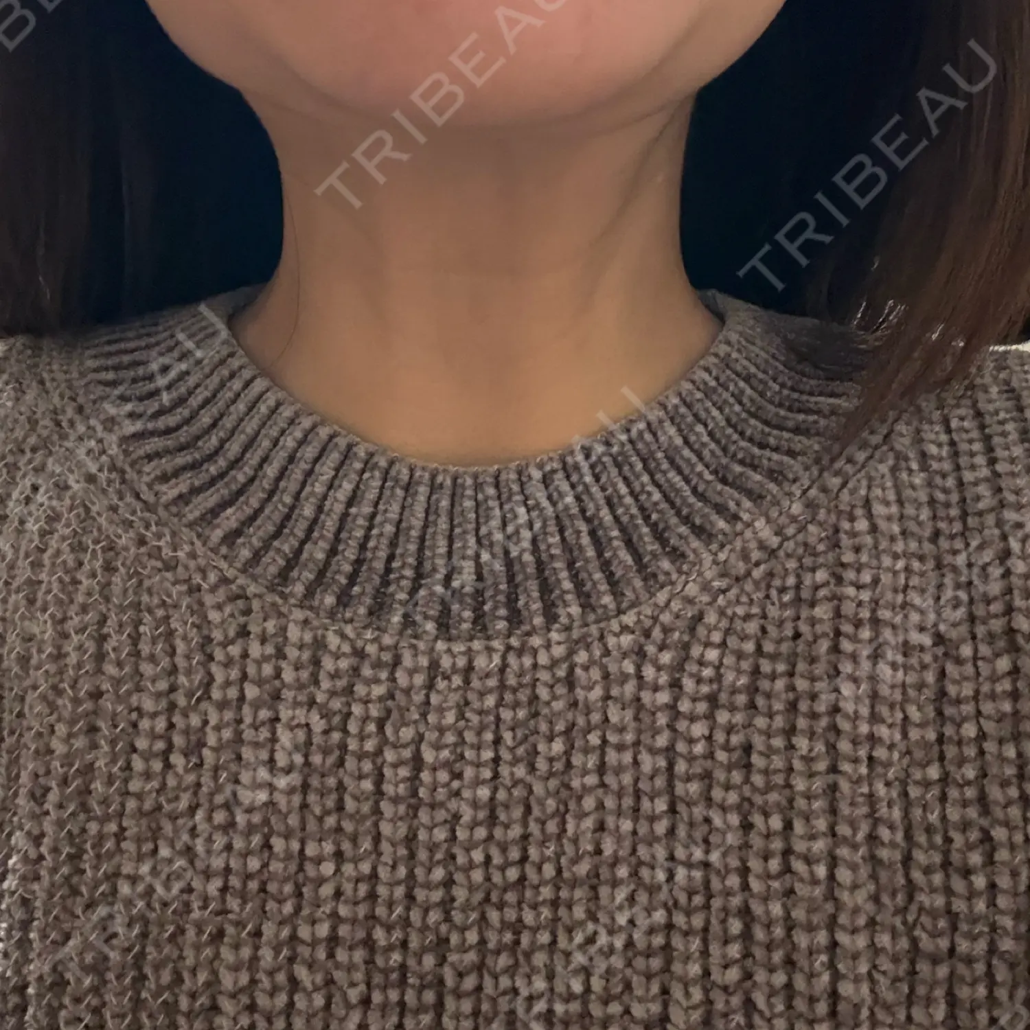 施術後の写真